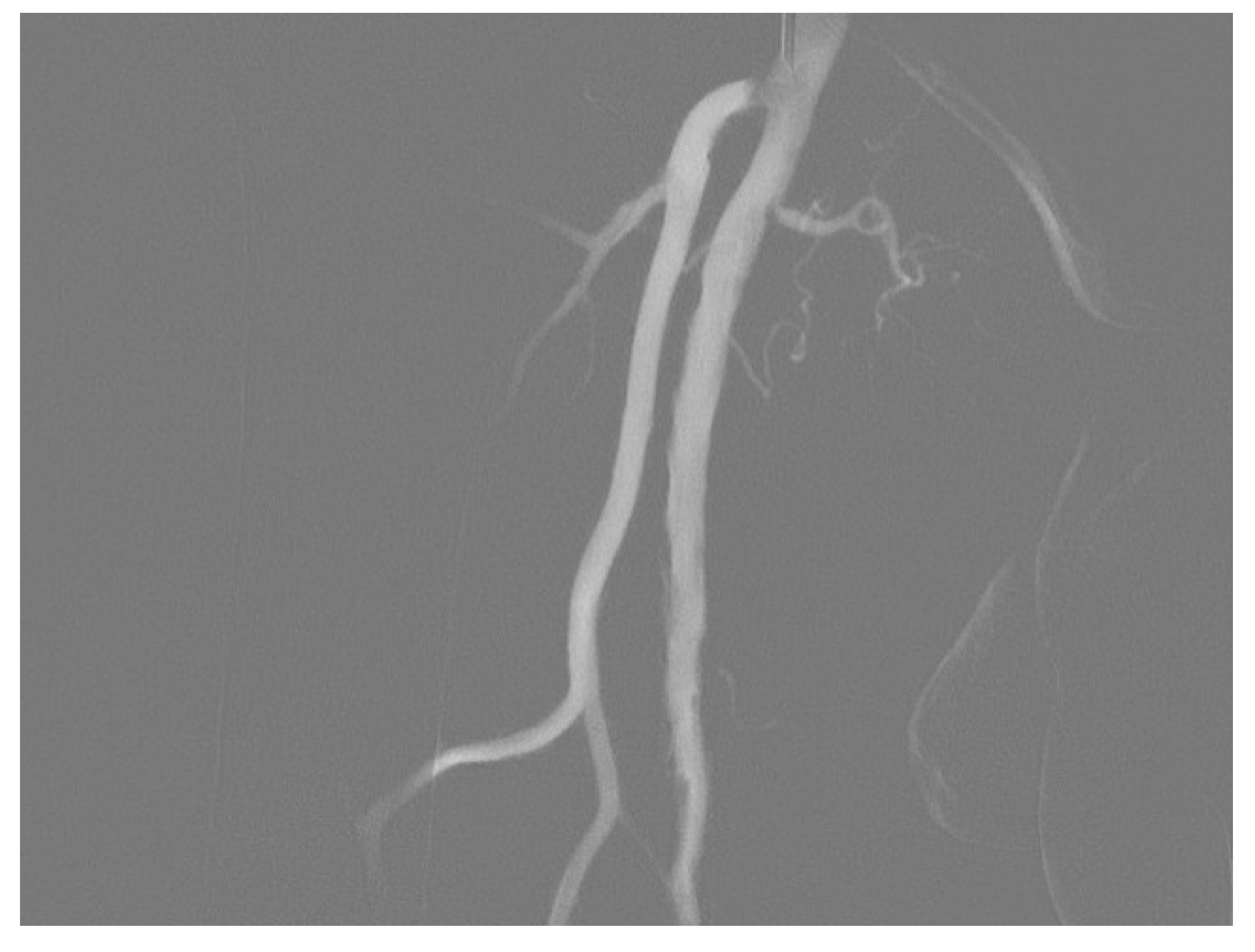 Radiation | Free Full-Text | Digital Angiography (DSA) Technical and Diagnostic Aspects in the Study of Lower Limb Arteries