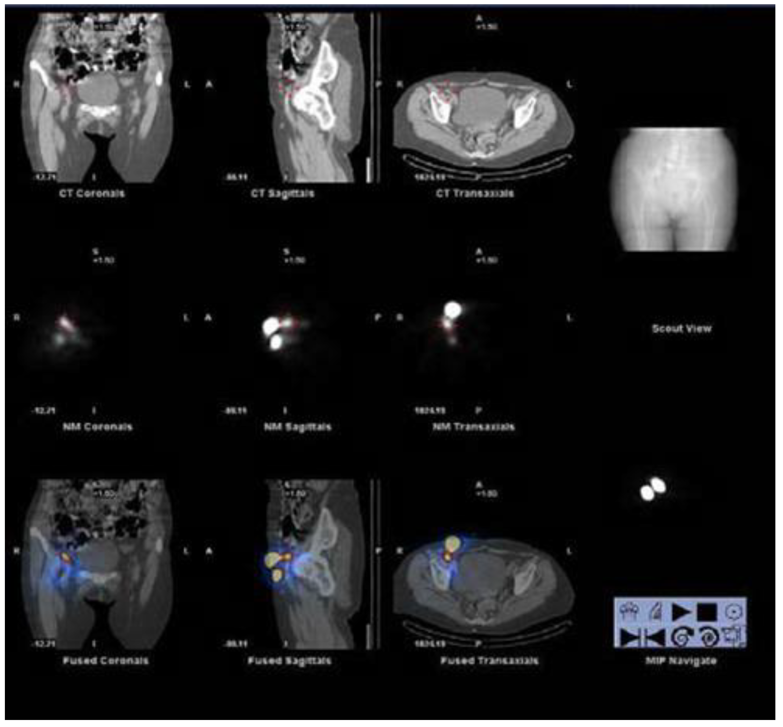 Radiation 03 00004 g002 Radiation 03 00004 g002