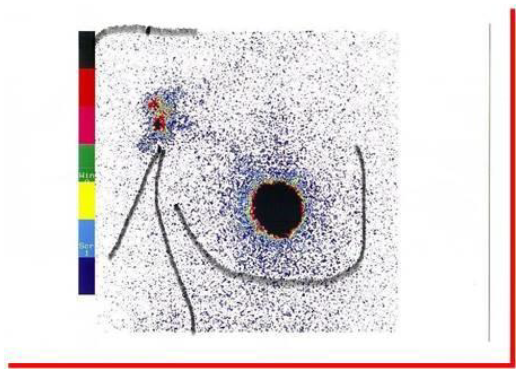 Radiation 03 00004 g003 Radiation 03 00004 g003