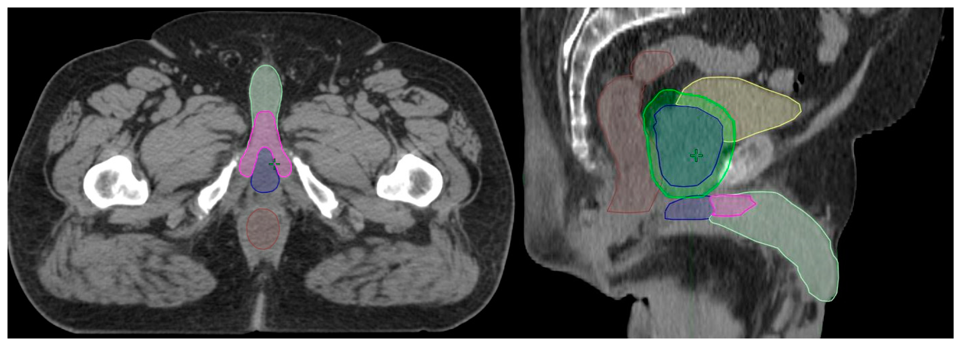Radiation 03 00008 g001