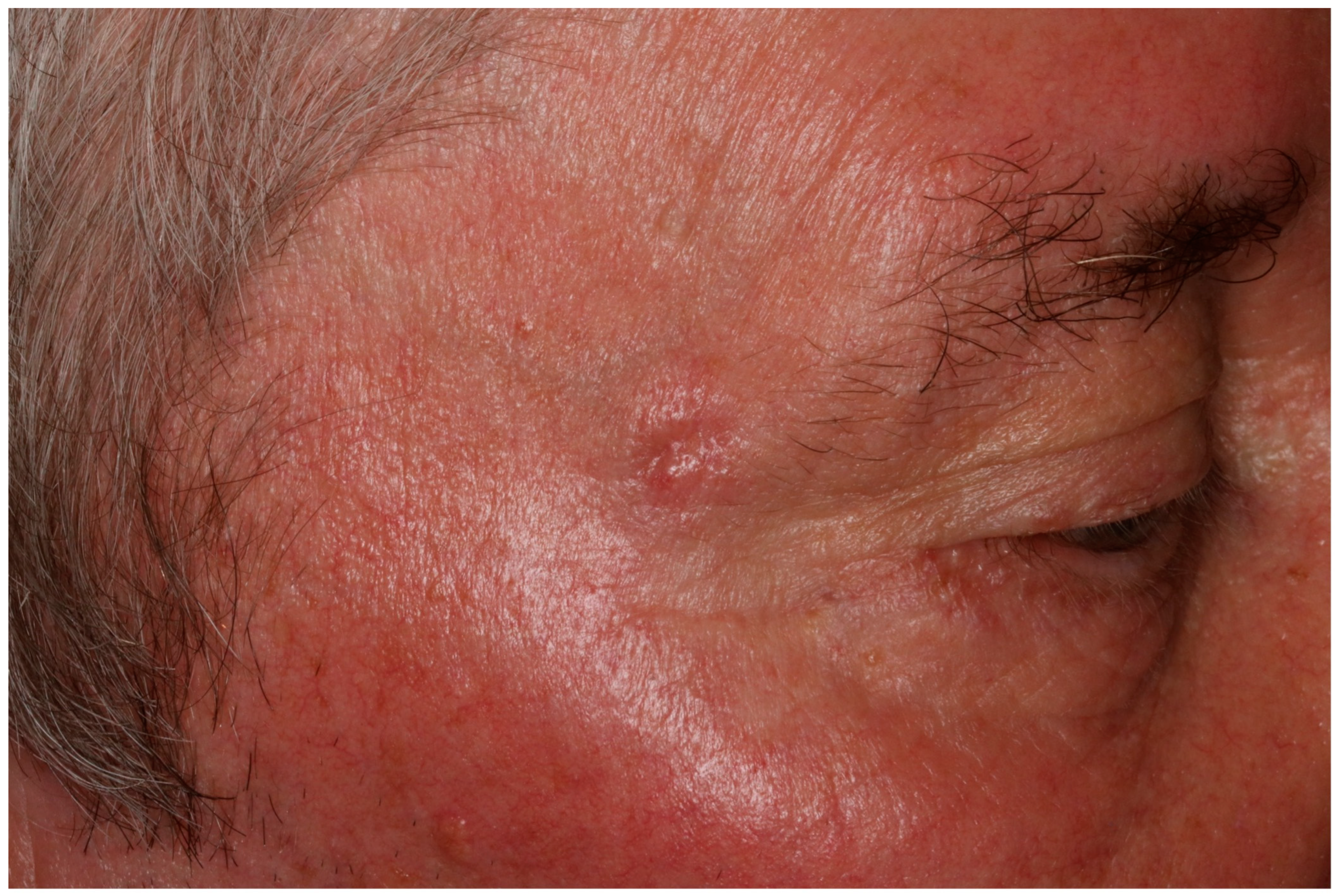 Radiation 03 00016 g001 Radiation 03 00016 g001