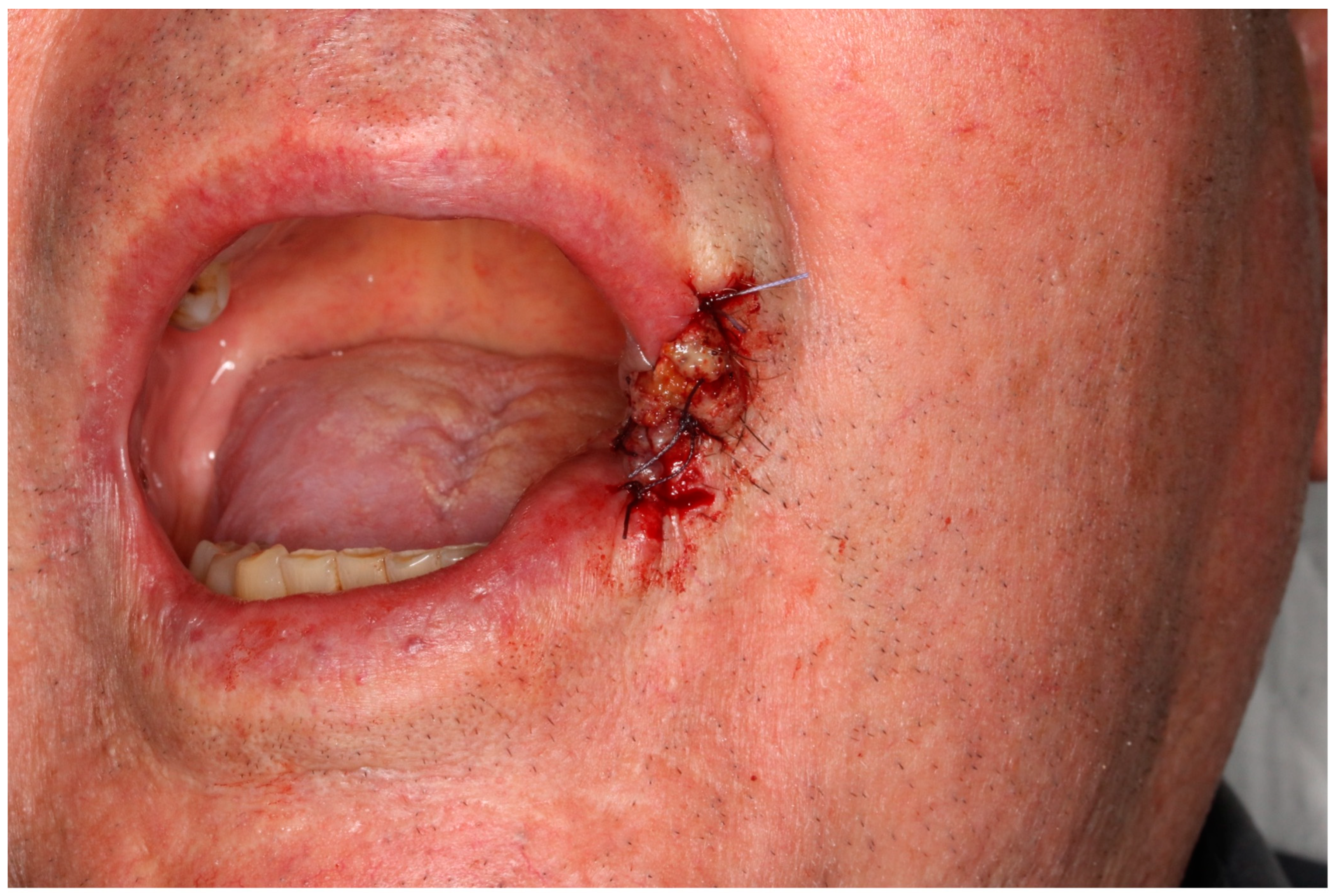 Radiation 03 00016 g002 Radiation 03 00016 g002