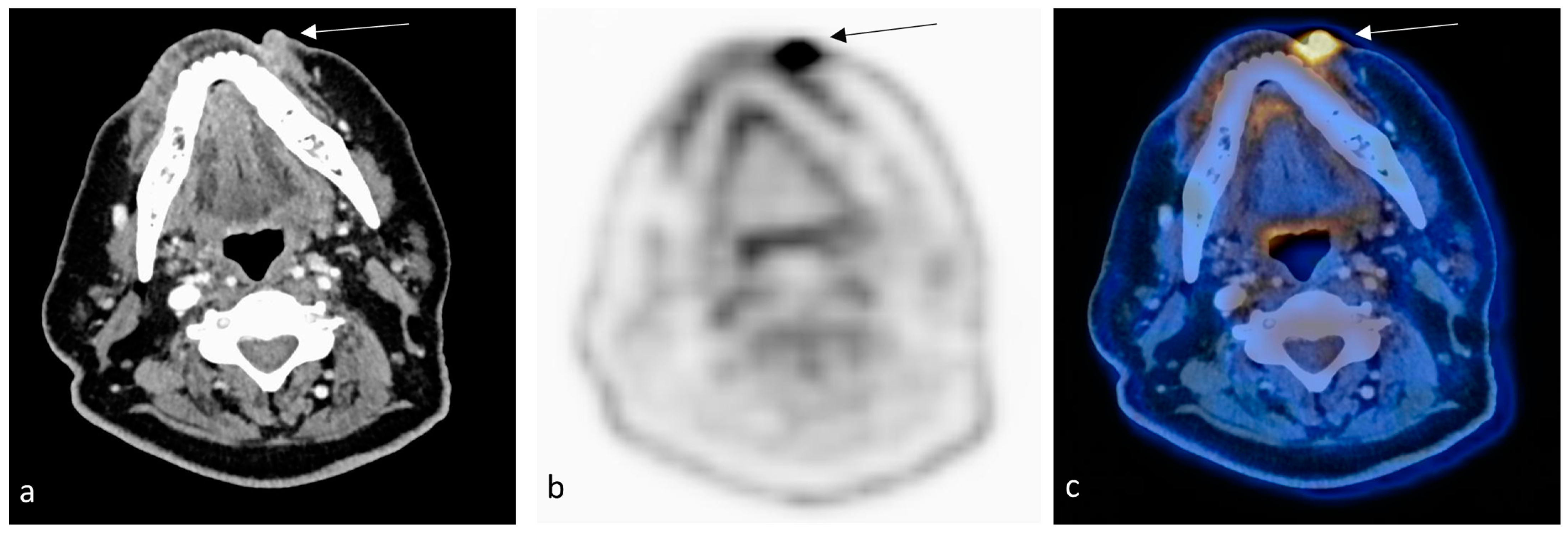 Radiation 03 00016 g003 Radiation 03 00016 g003