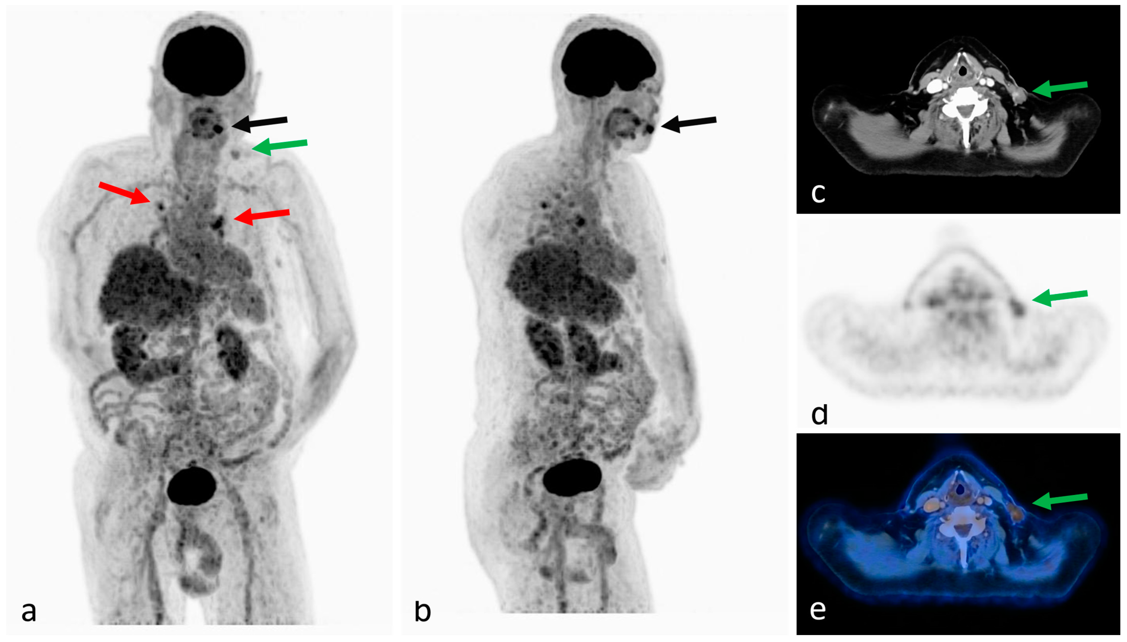 Radiation 03 00016 g004 Radiation 03 00016 g004