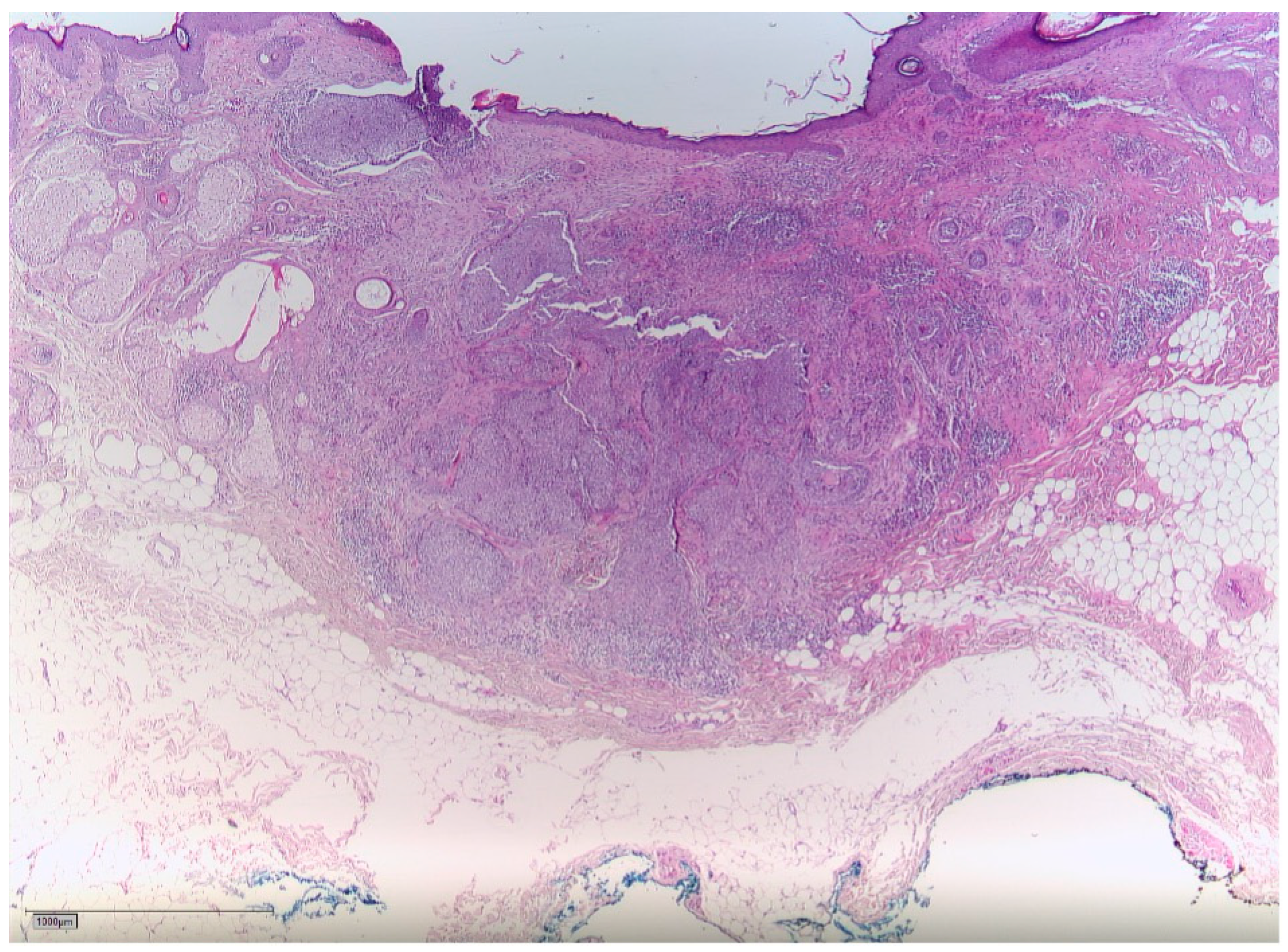 Radiation 03 00016 g005 Radiation 03 00016 g005