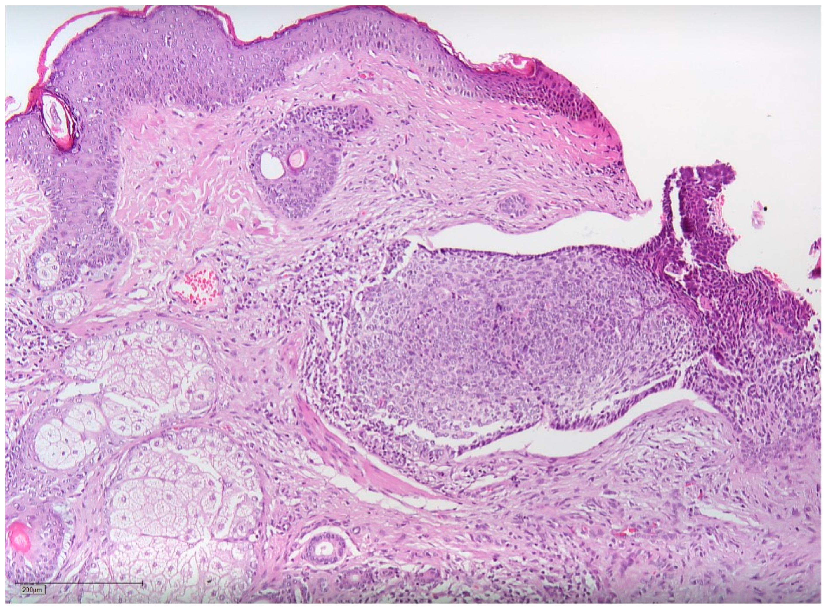 Radiation 03 00016 g006 Radiation 03 00016 g006