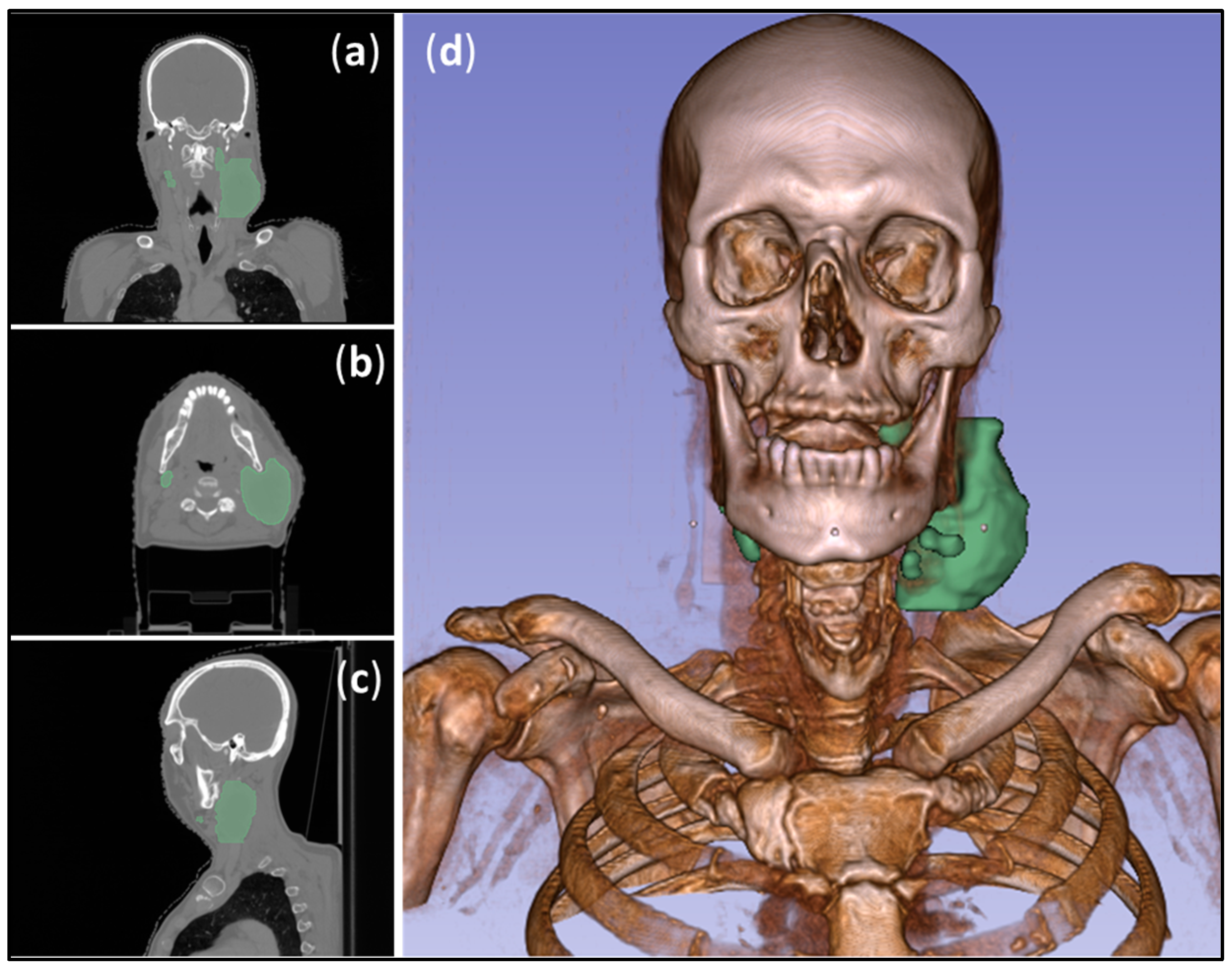 Radiation 04 00005 g002