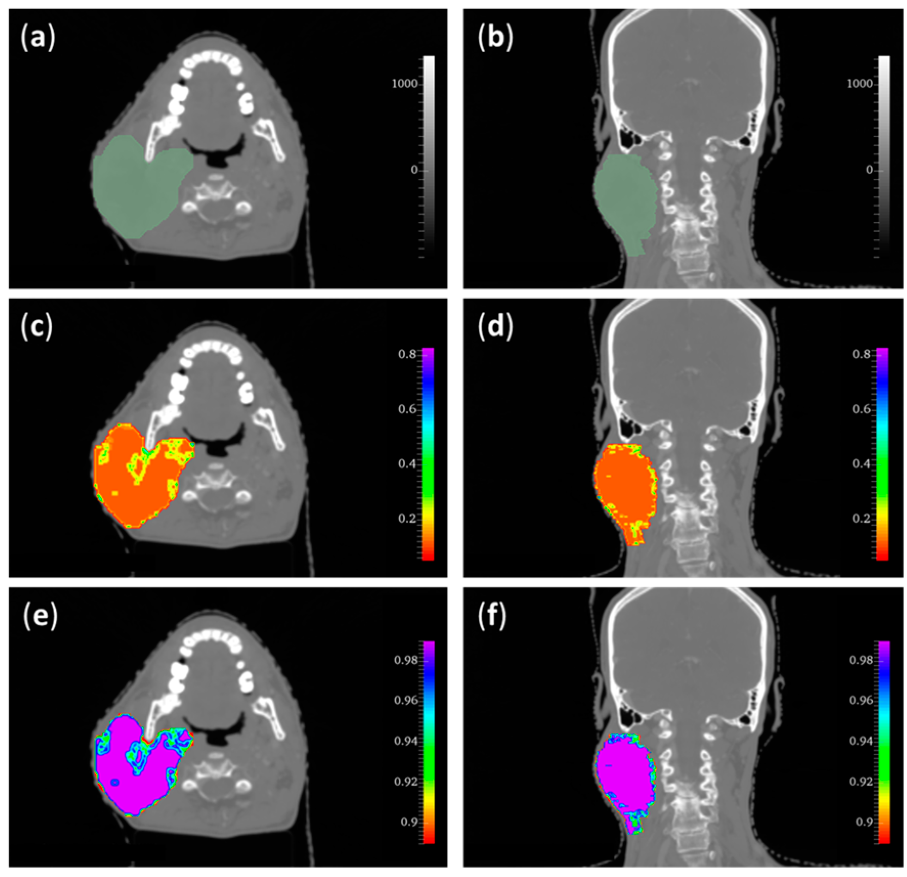 Radiation 04 00005 g003