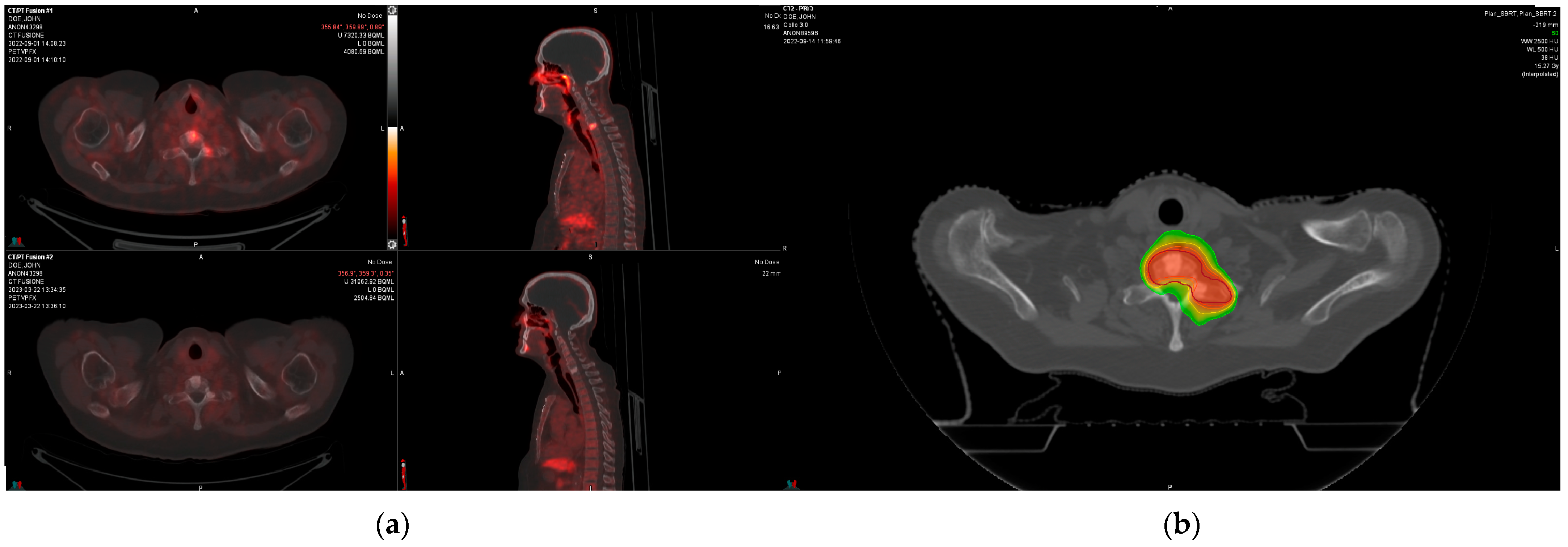 Radiation 04 00009 g001
