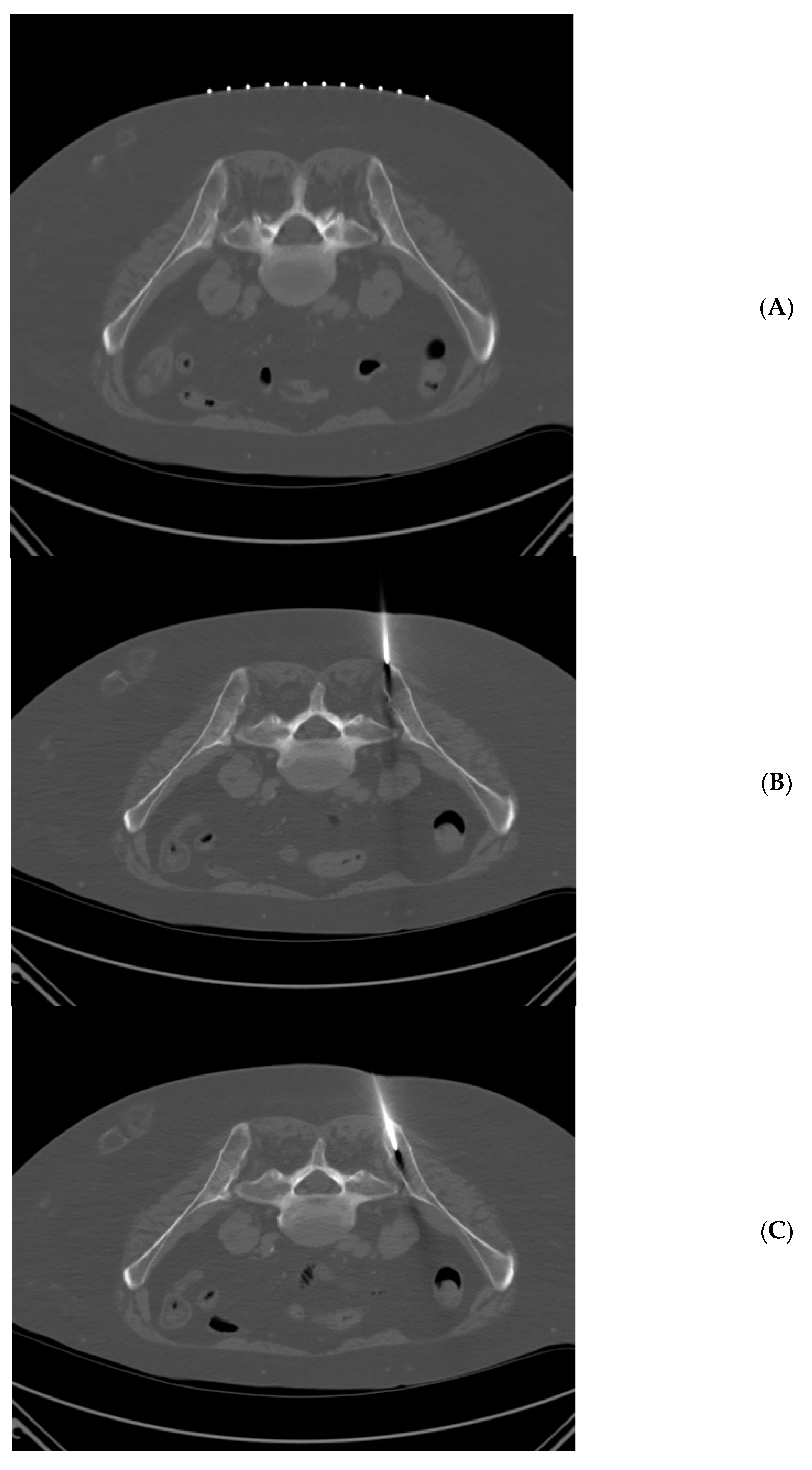 Radiation 04 00017 g002