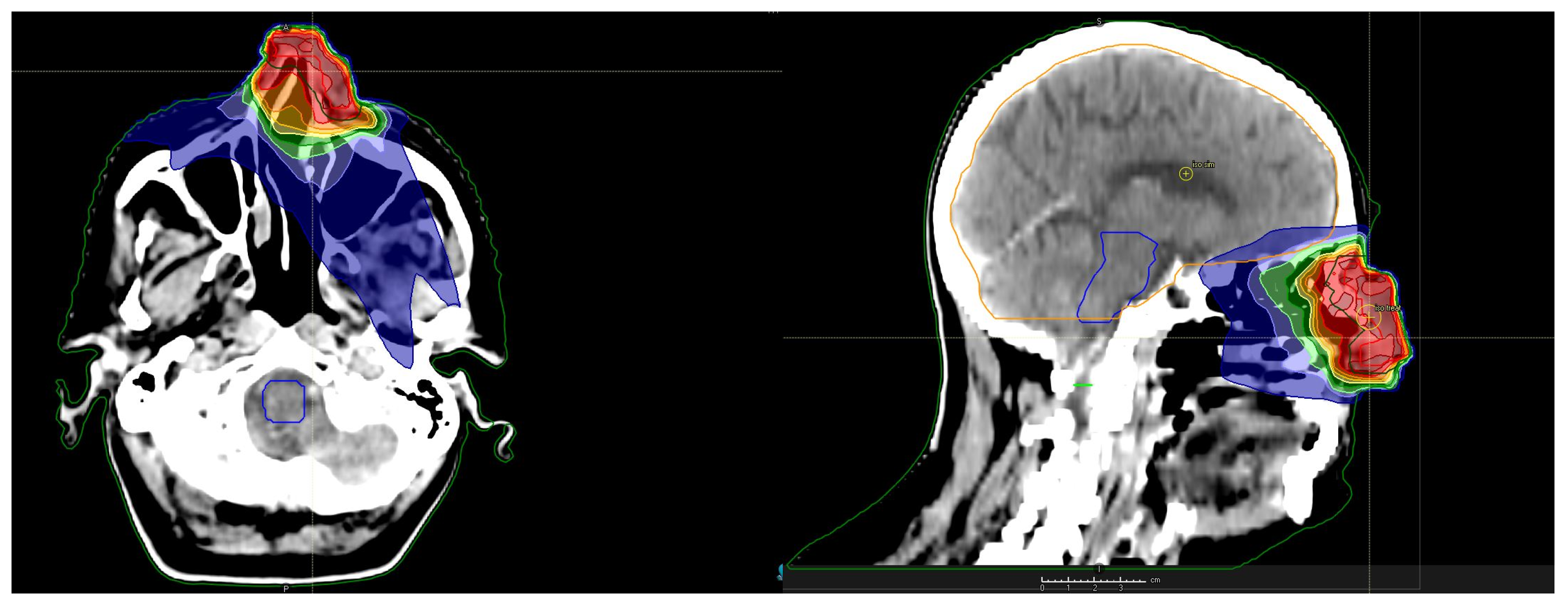 Radiation 04 00018 g003