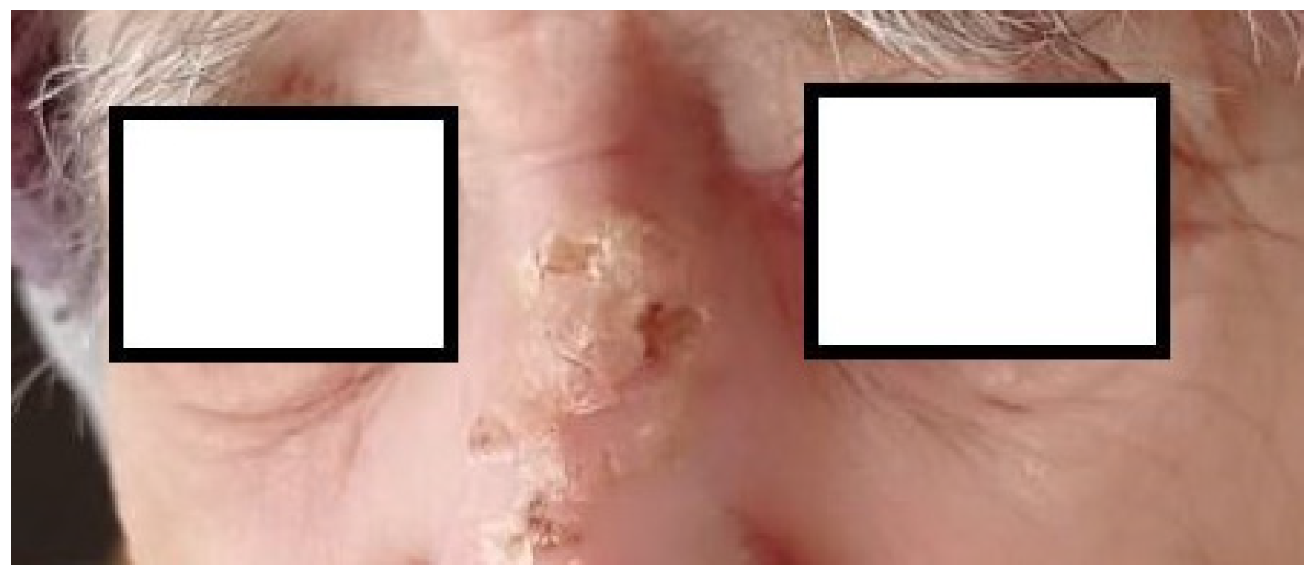 Radiation 04 00018 g004