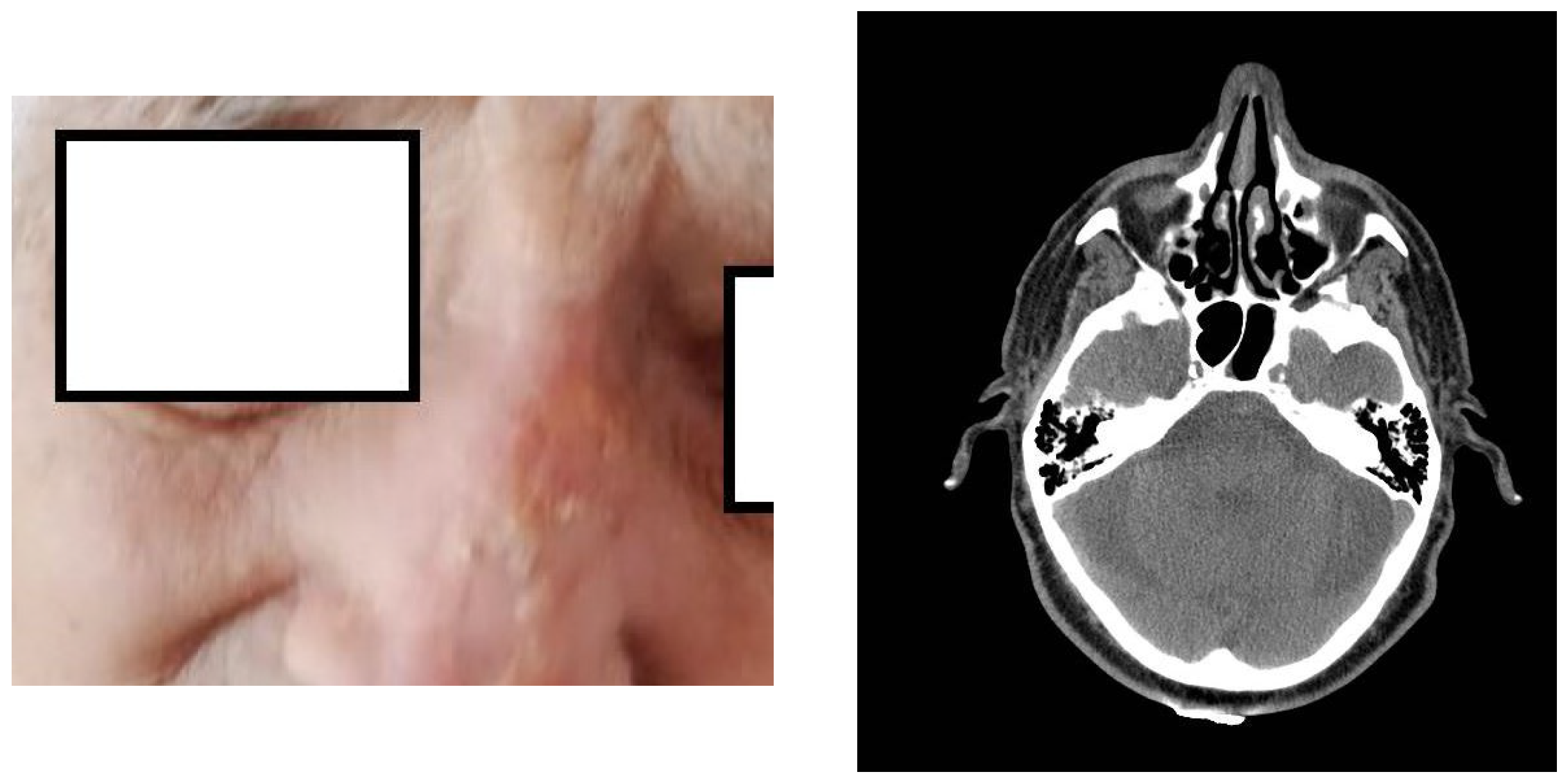 Radiation 04 00018 g005