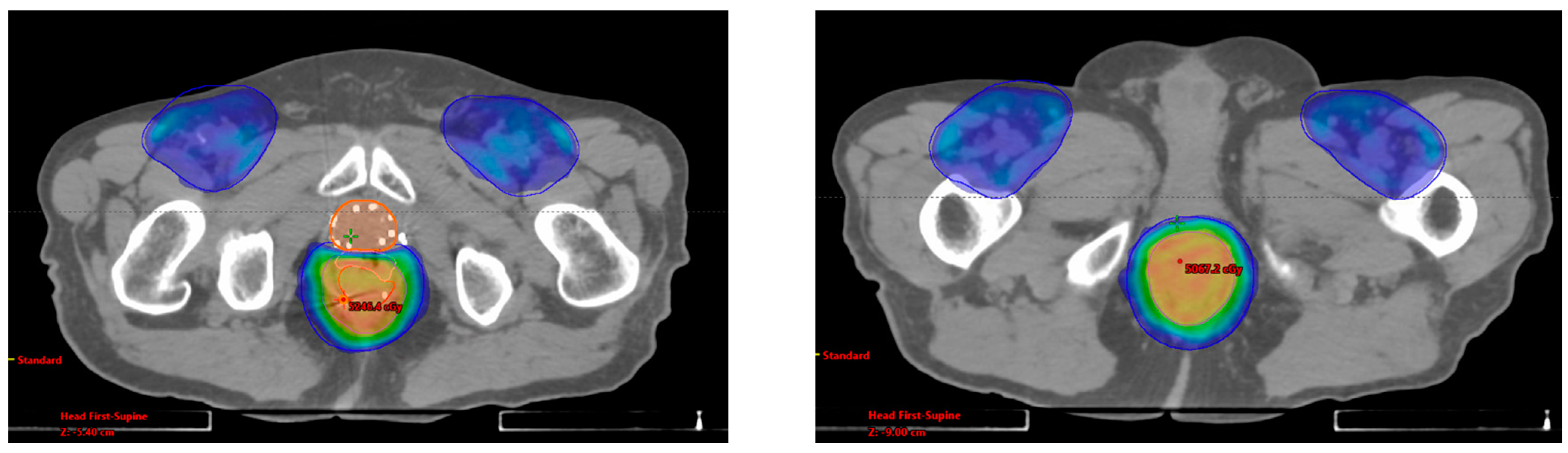 Radiation 04 00019 g002c