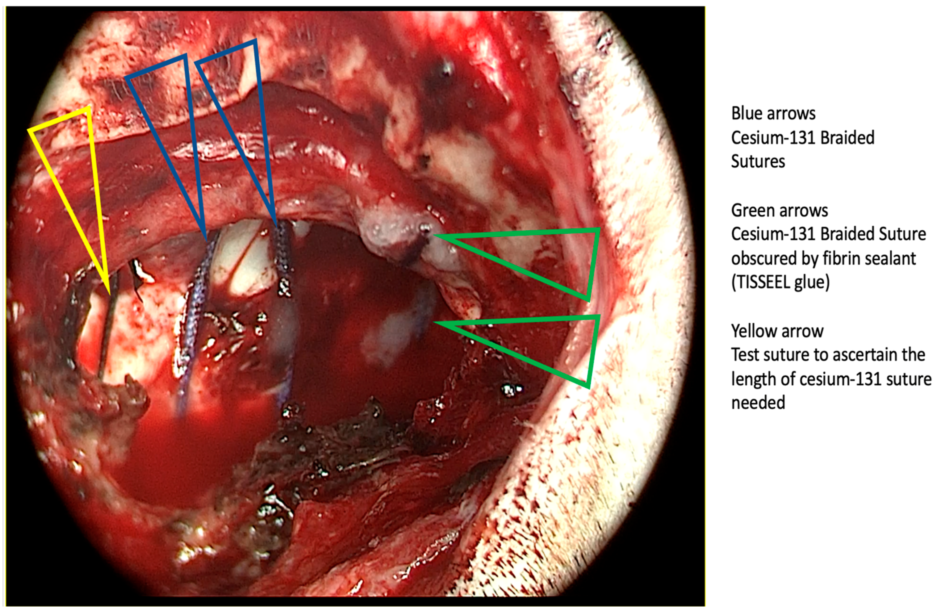 Radiation 05 00013 g003