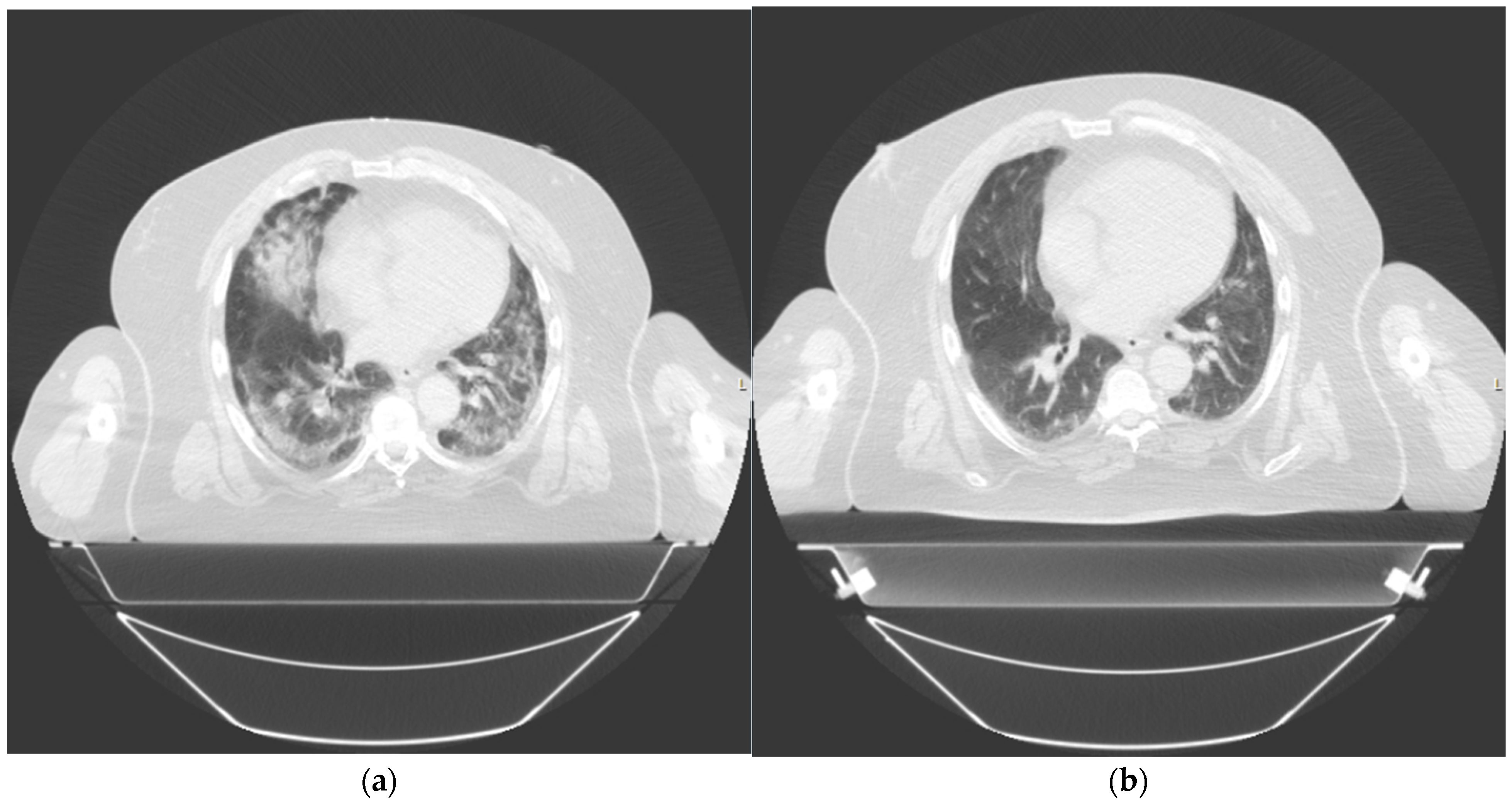 Radiation 05 00019 g003