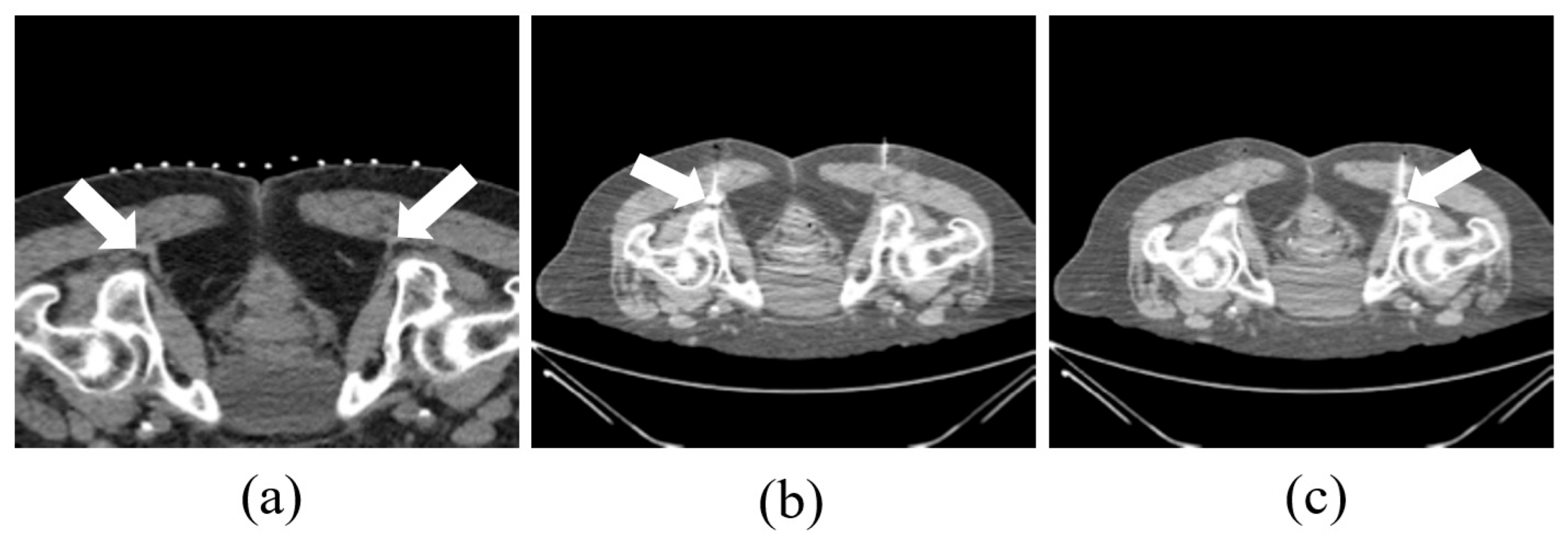 Radiation 05 00028 g002 Radiation 05 00028 g002