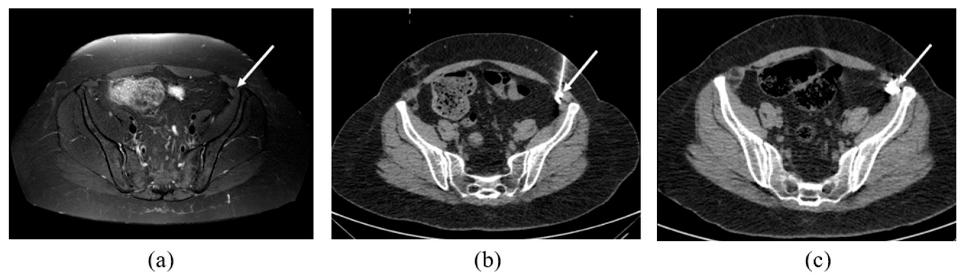 Radiation 05 00028 g003 Radiation 05 00028 g003