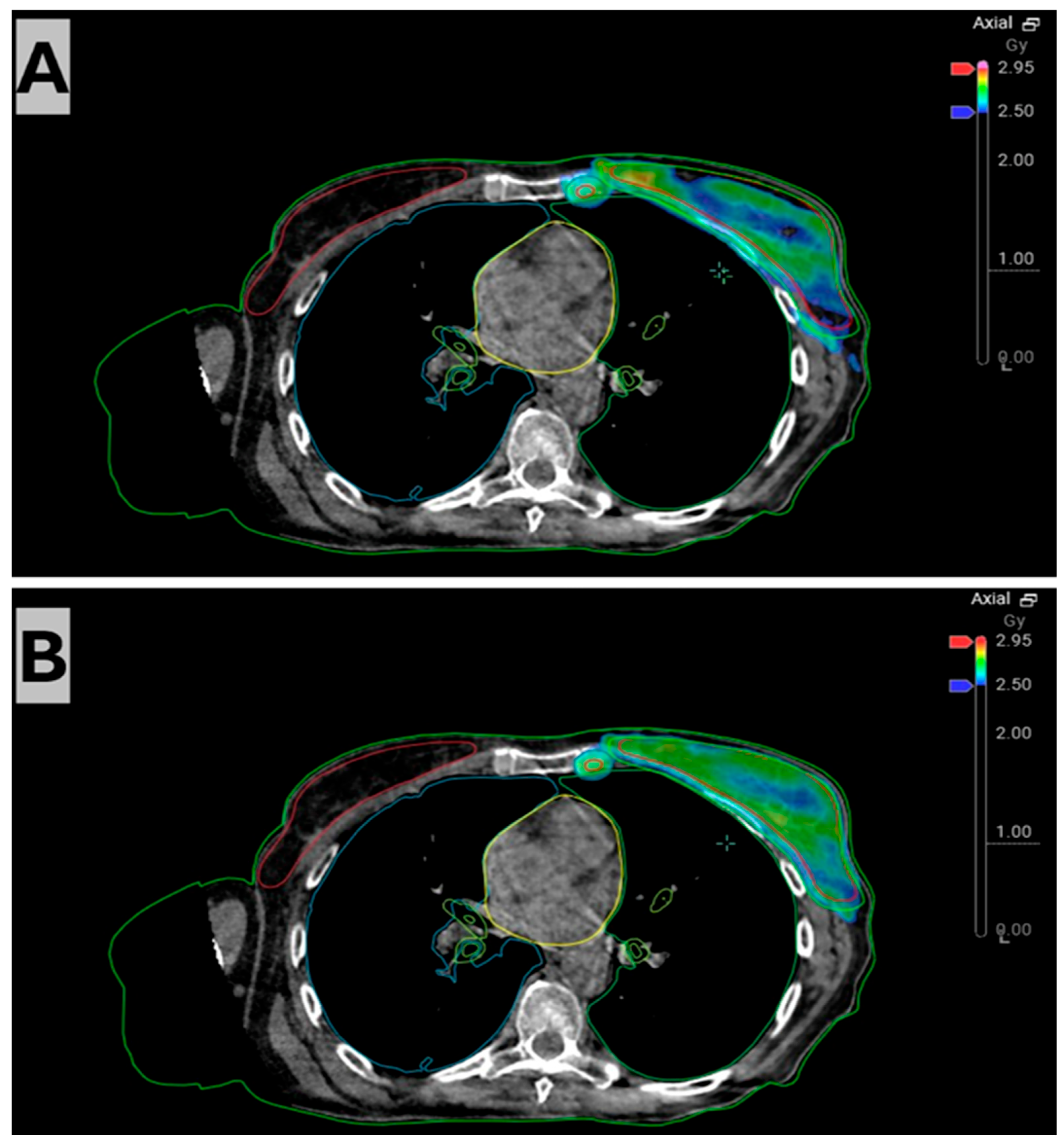Radiation 05 00034 g003