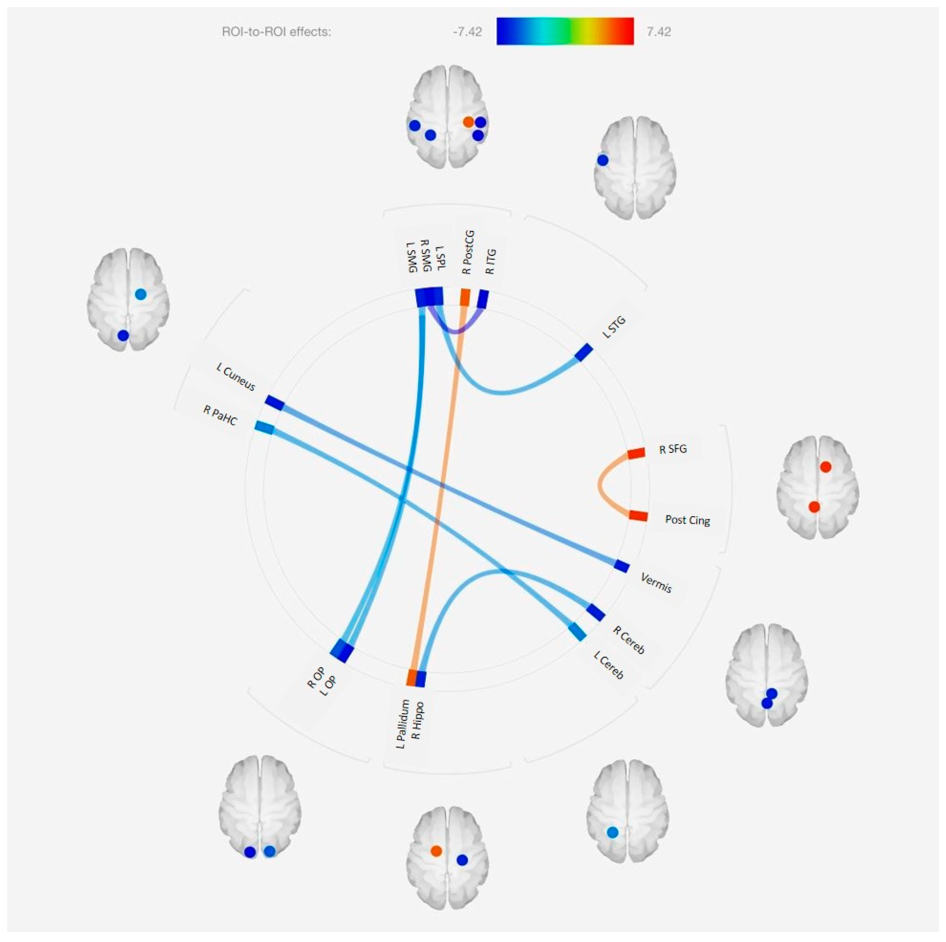 Religions Free Full-Text Effect of a One-Week Spiritual Retreat on Brain Functional Connectivity A Preliminary Study