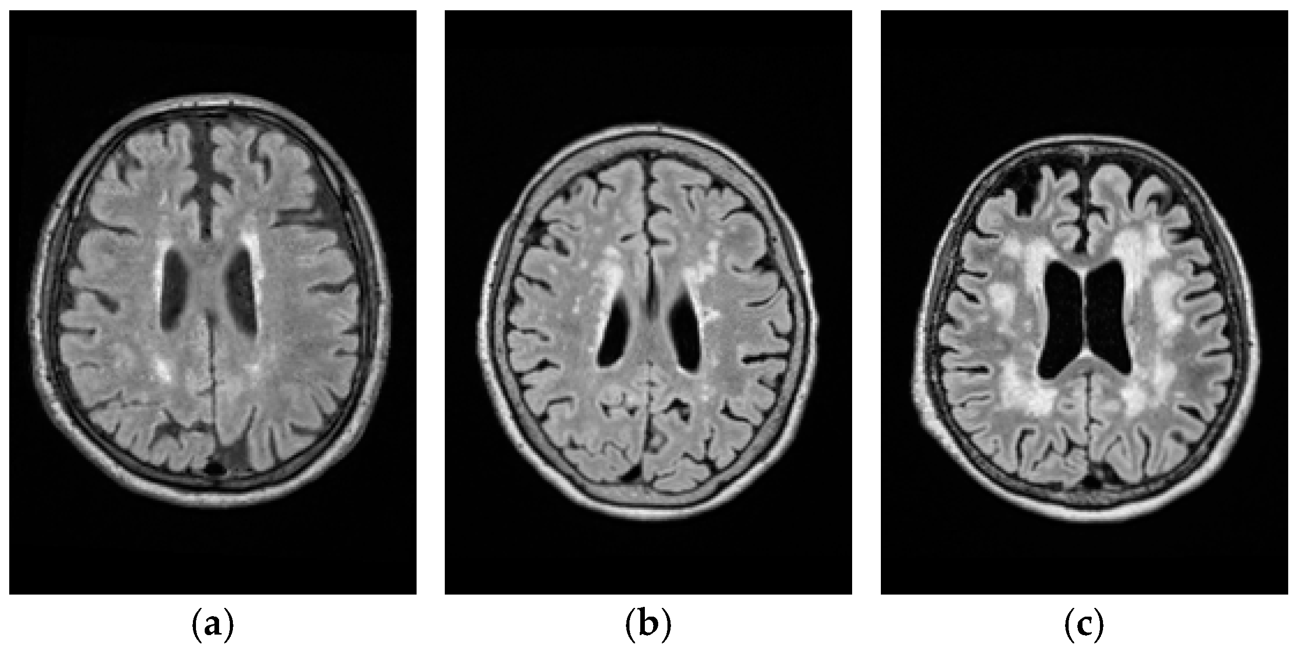 Remotesensing 09 01174 g011