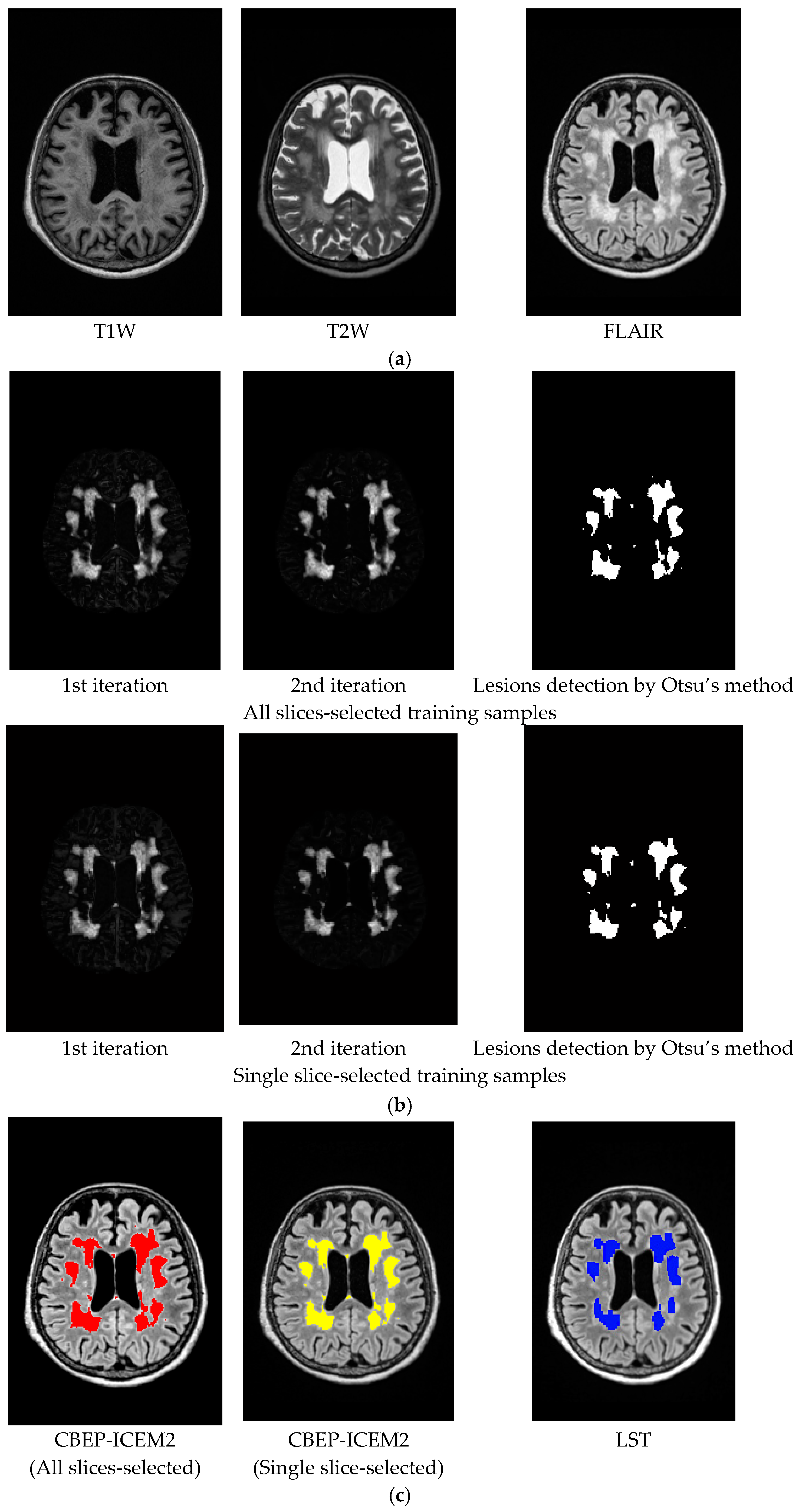 Remotesensing 09 01174 g014