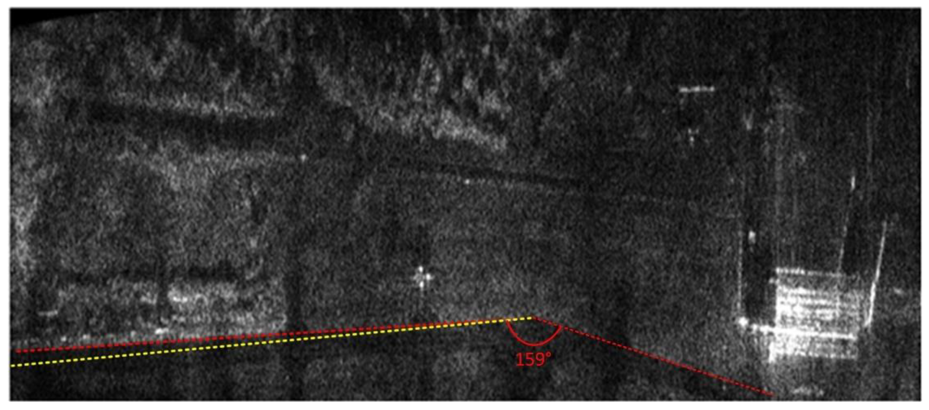 Remotesensing 12 03639 g013