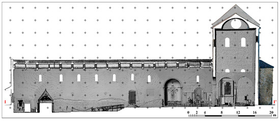 Three-Dimensional Modeling and Non-Invasive Diagnosis of a Huge