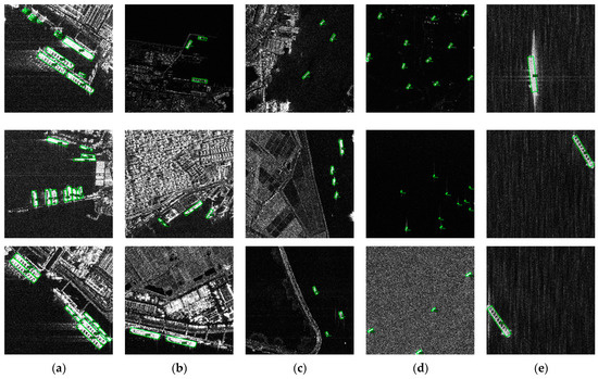 MT-FANet: A Morphology and Topology-Based Feature Alignment Network for ...