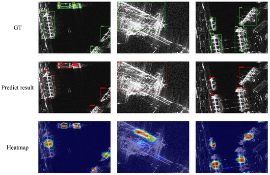BDショット 4本セット SONY デジタルオーディオプレーヤー WALKMAN(ウォークマン