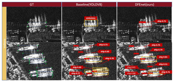Denoising and Feature Enhancement Network for Target Detection Based on ...