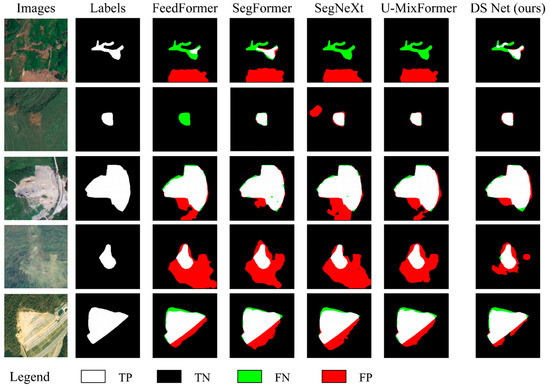 MSA DS Net: A Dual-Coded Segmentation Network Leveraging Large