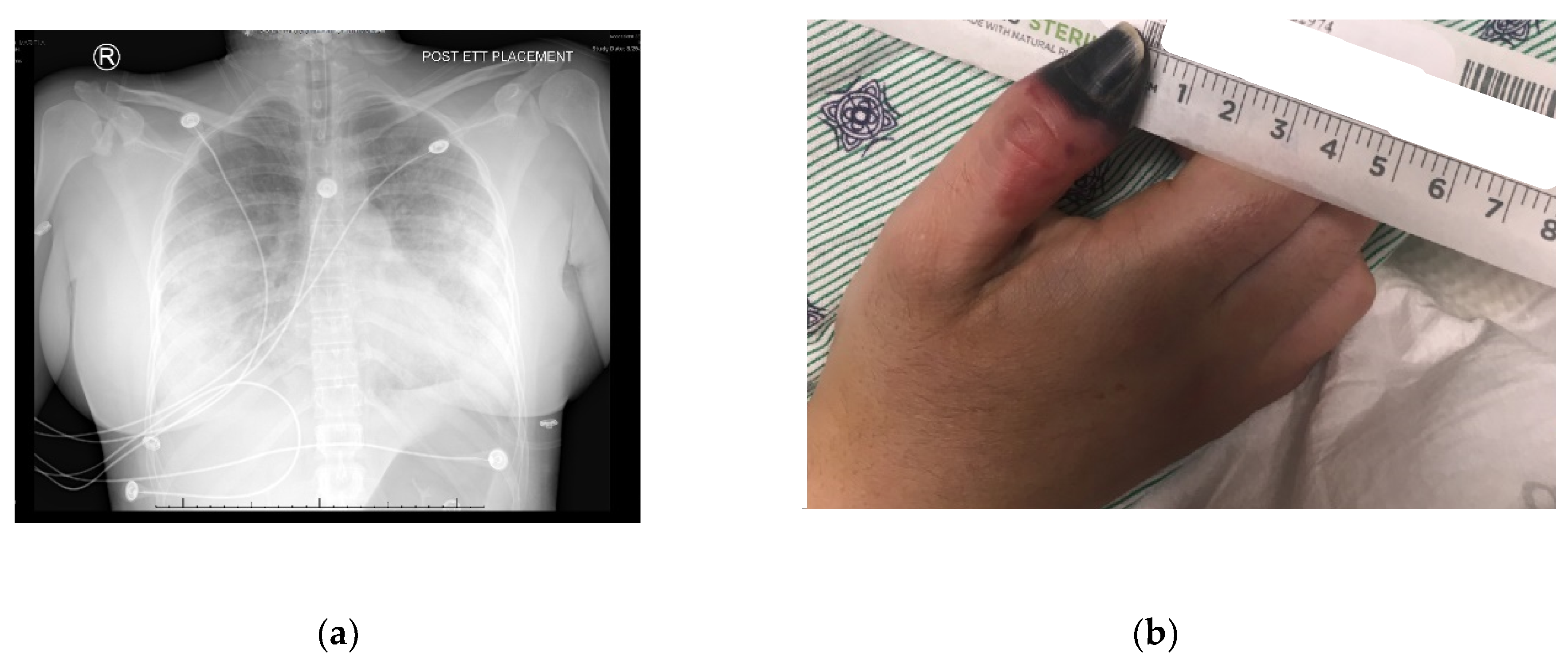 Reports 02 00023 g001 Reports 02 00023 g001