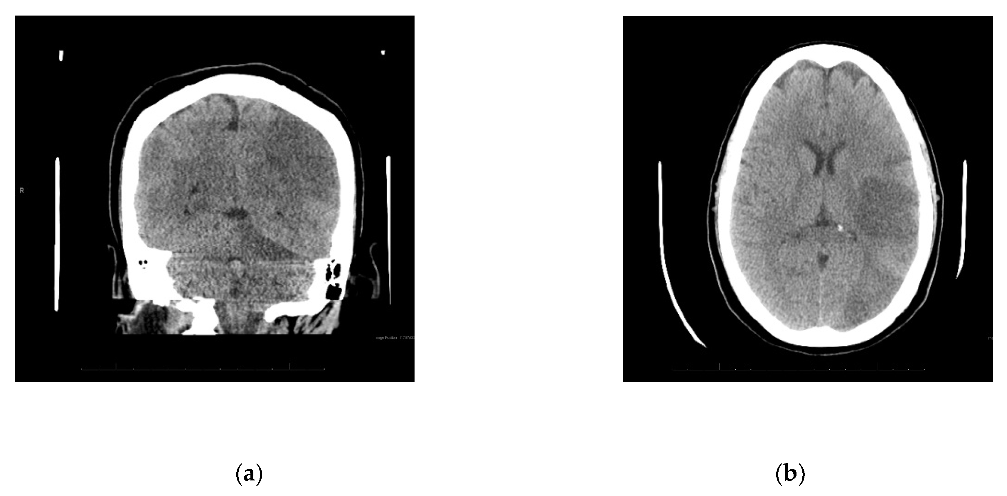 Reports 02 00023 g002 Reports 02 00023 g002