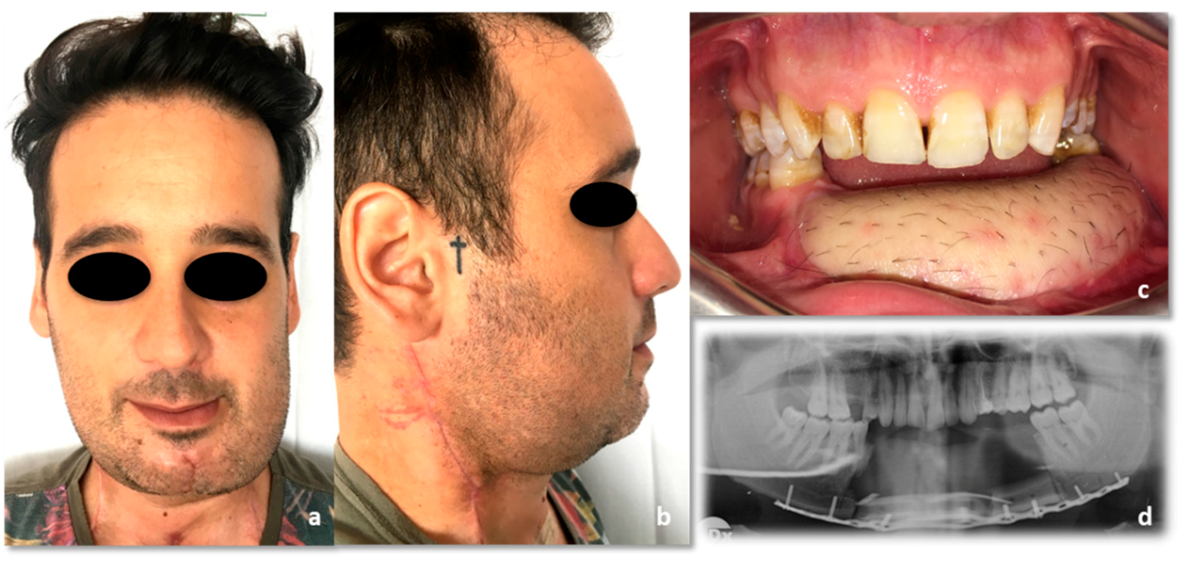 Reports 03 00012 g011 Reports 03 00012 g011