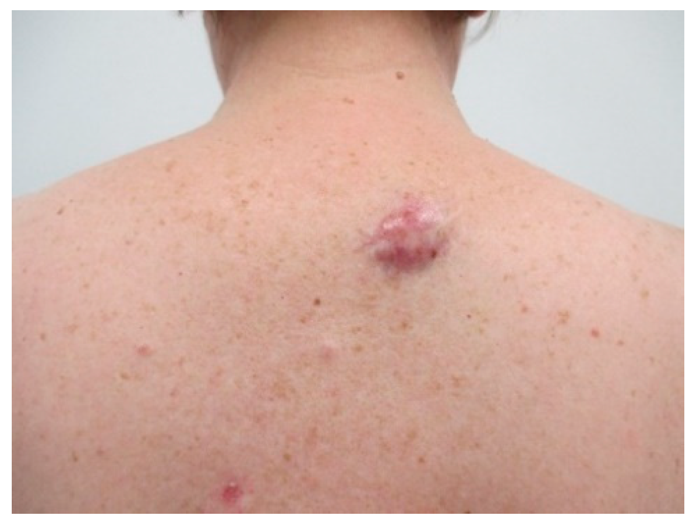 Reports 03 00028 g008 Reports 03 00028 g008