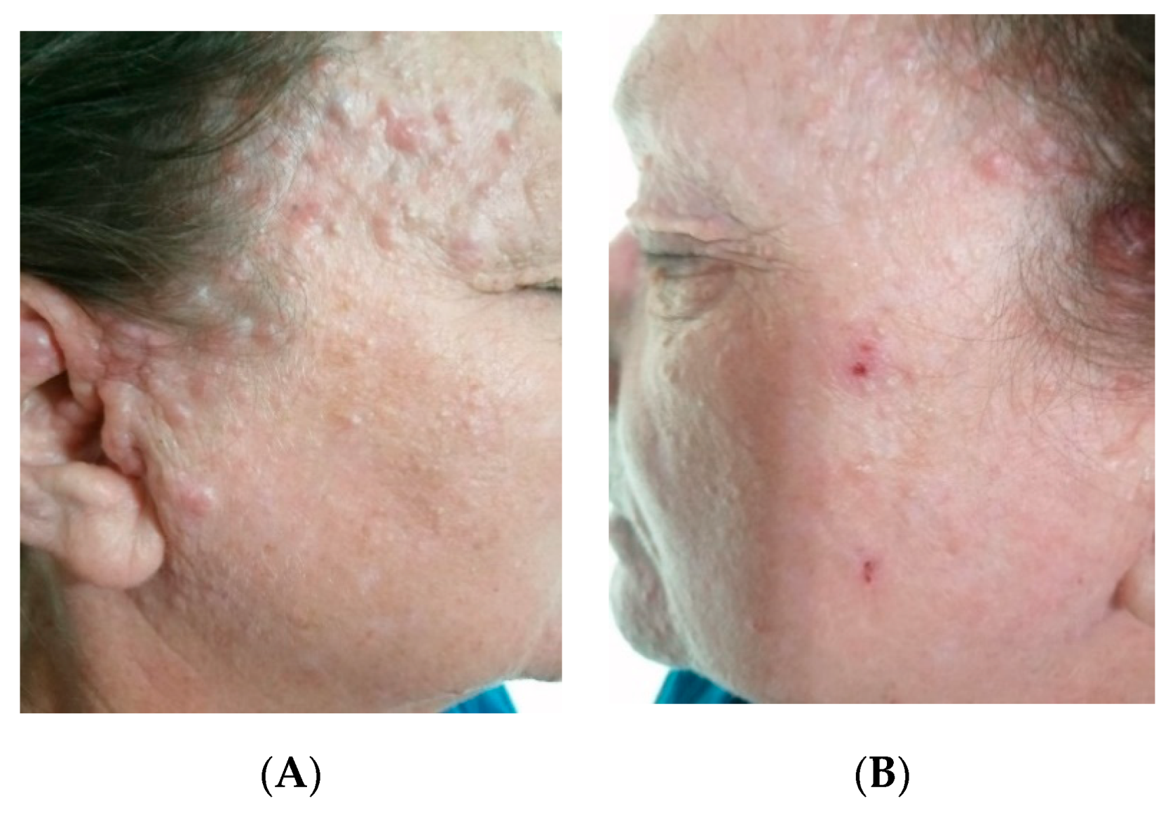 Reports 03 00028 g011 Reports 03 00028 g011