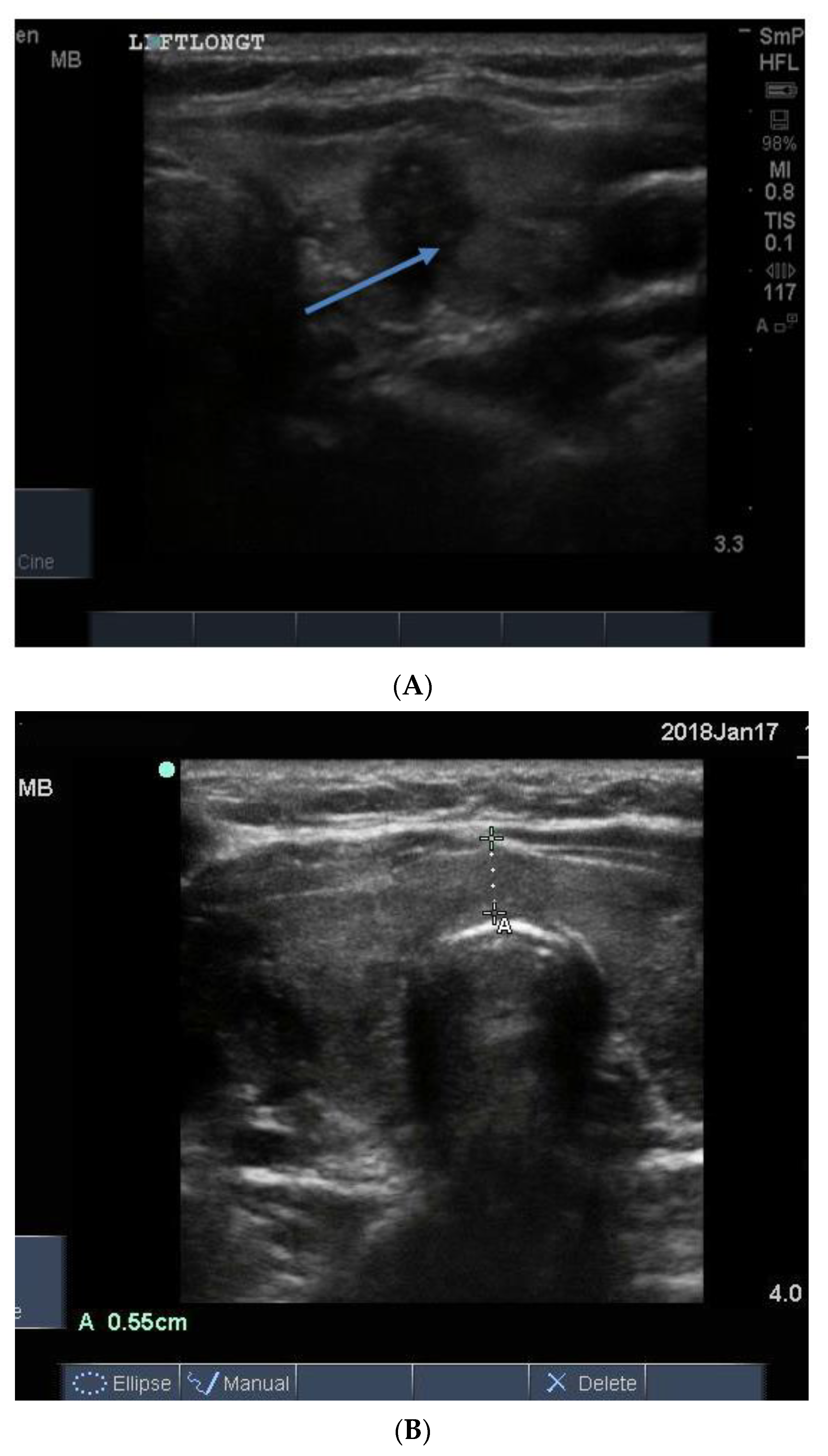 Reports 04 00008 g015a