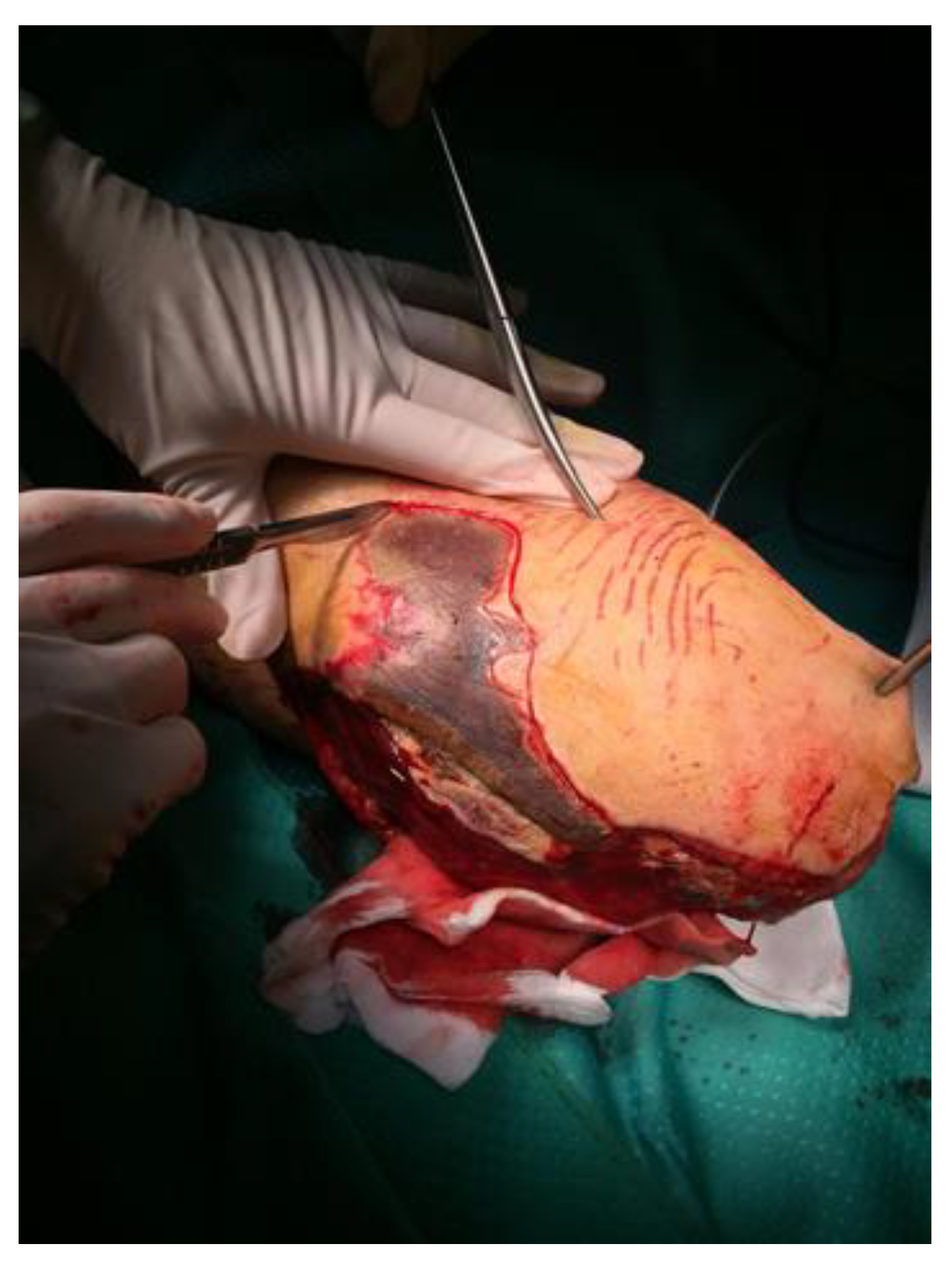 Reports 04 00009 g002 Reports 04 00009 g002