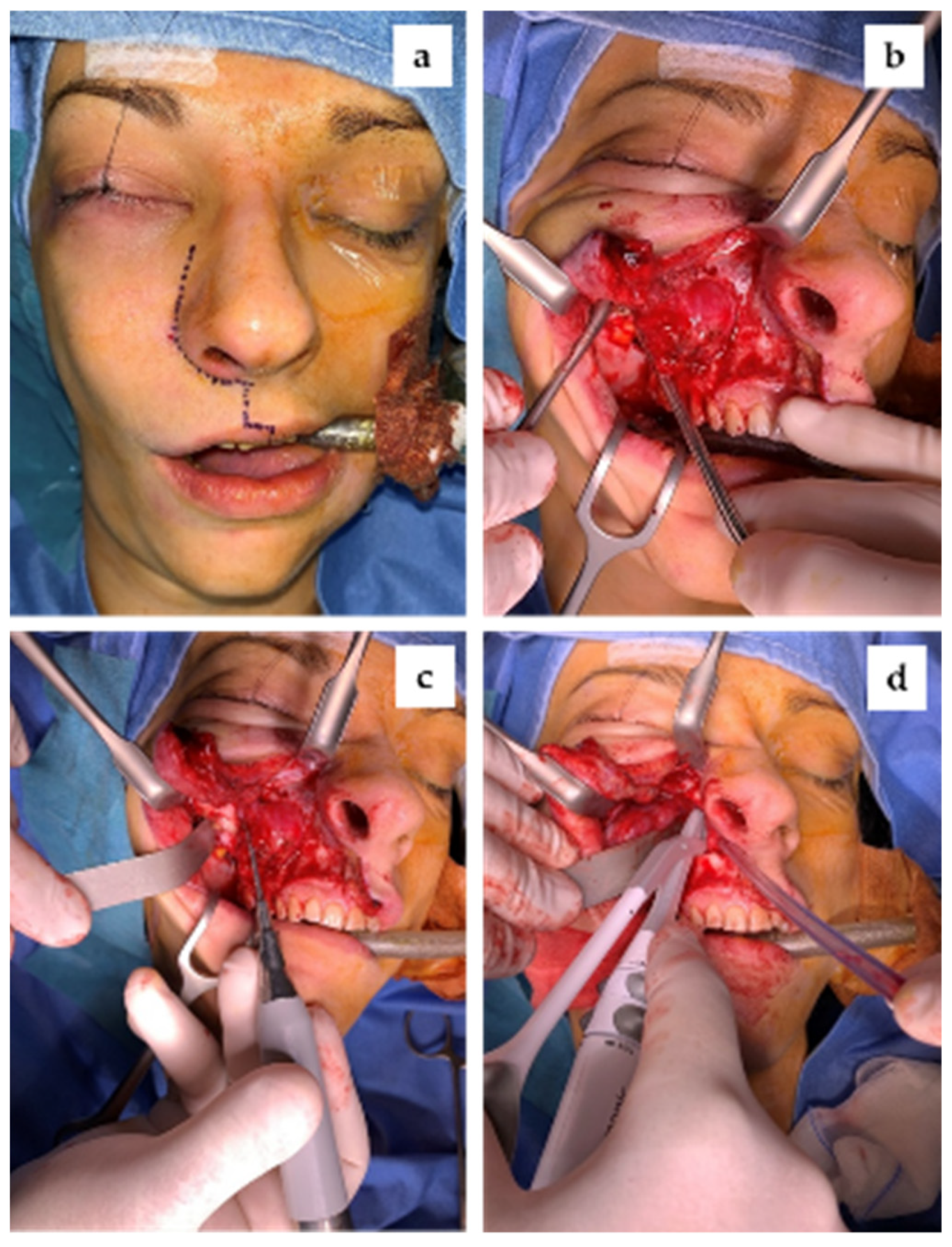 Reports 04 00033 g005 Reports 04 00033 g005