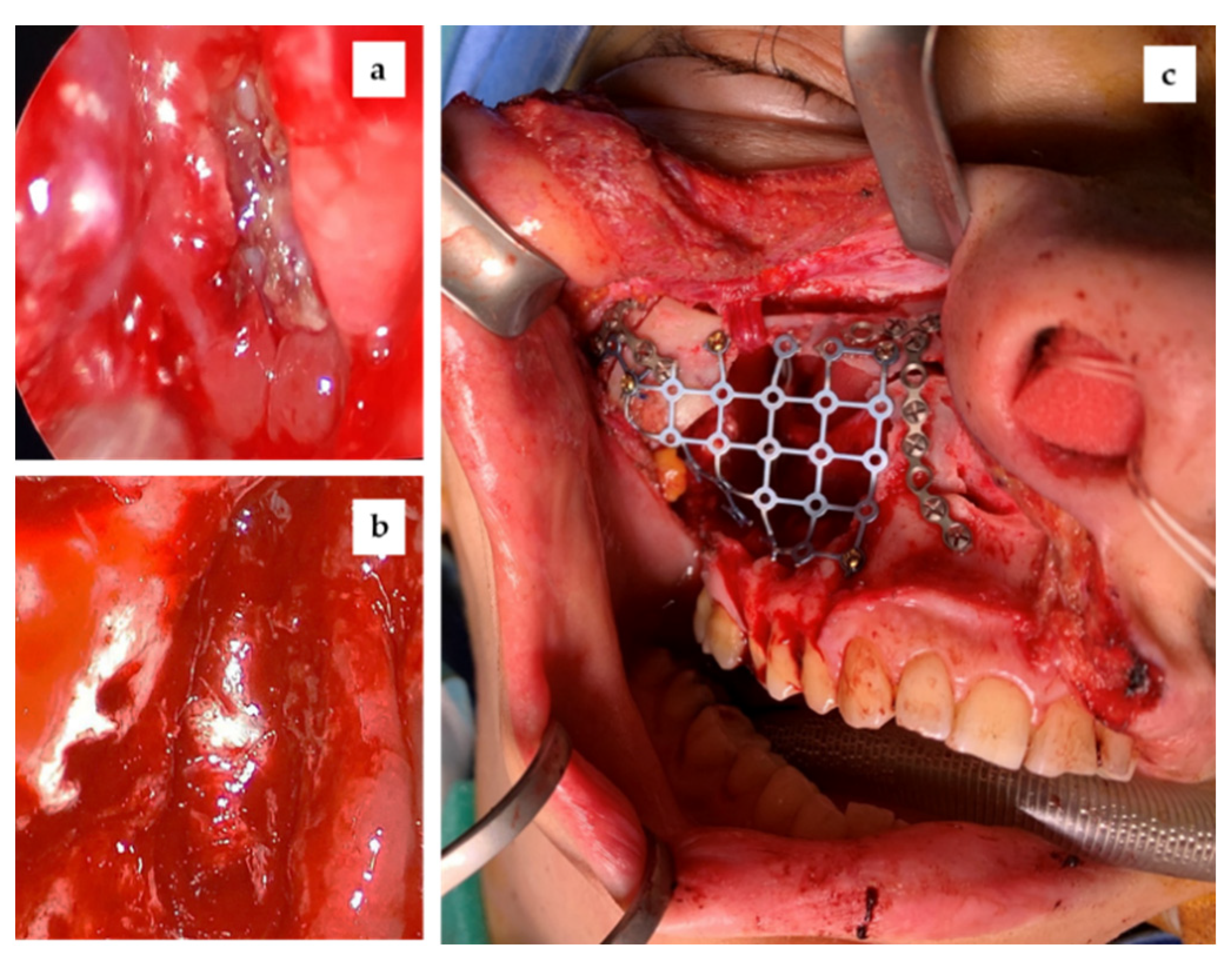 Reports 04 00033 g007 Reports 04 00033 g007