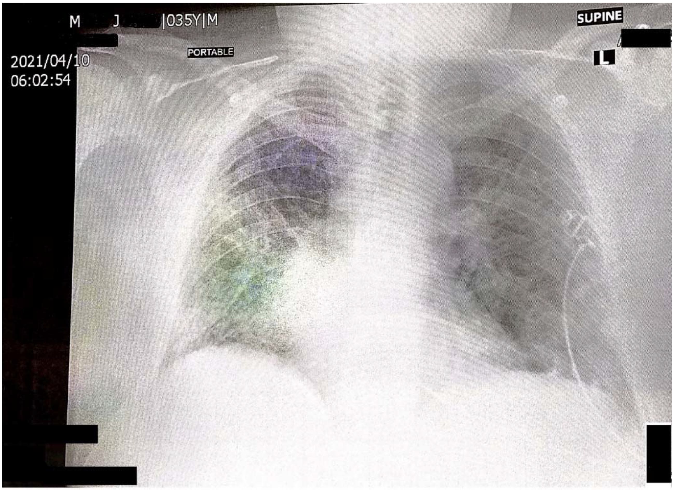 Reports 05 00011 g001 550