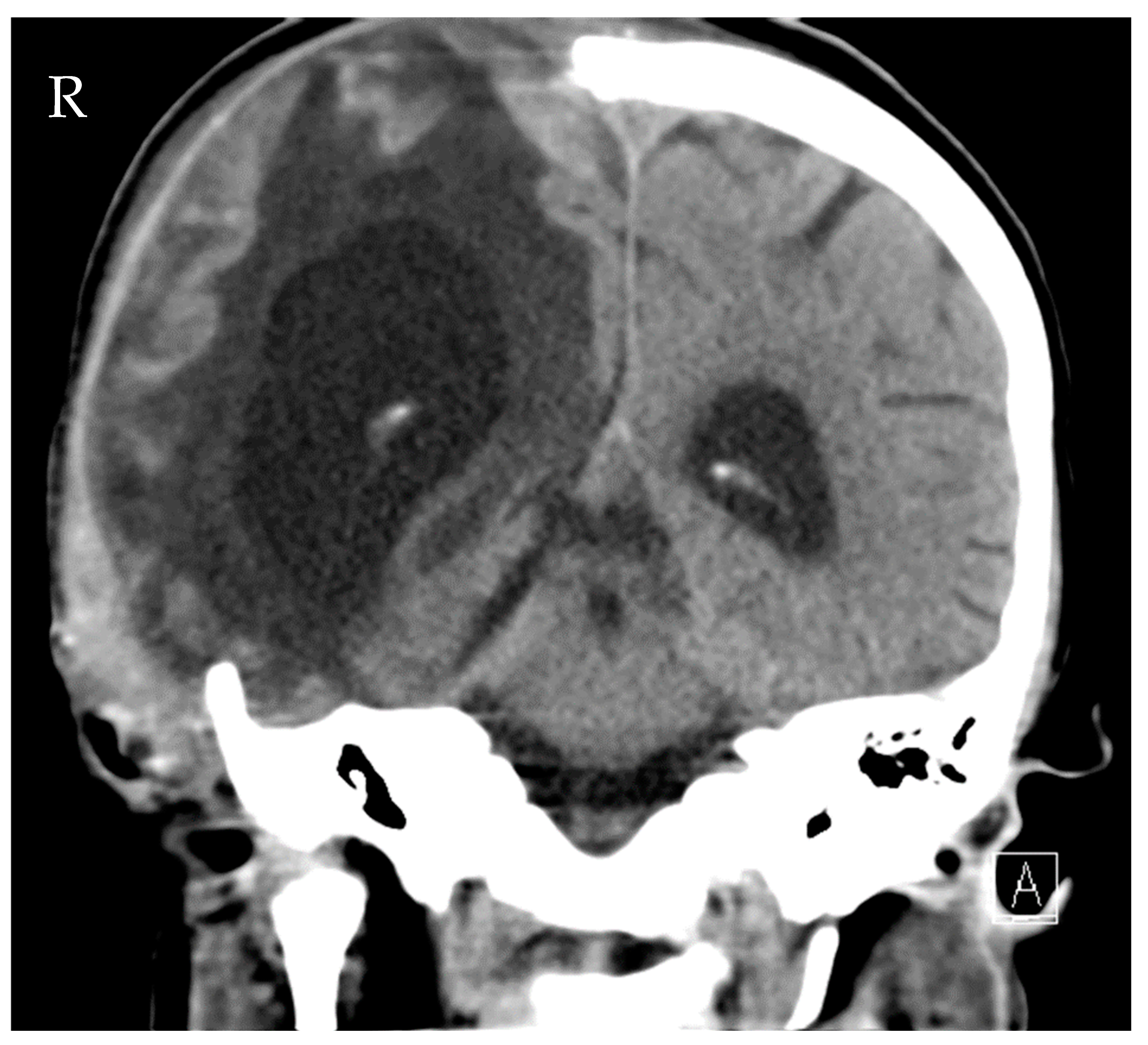 Reports 05 00033 g004 550