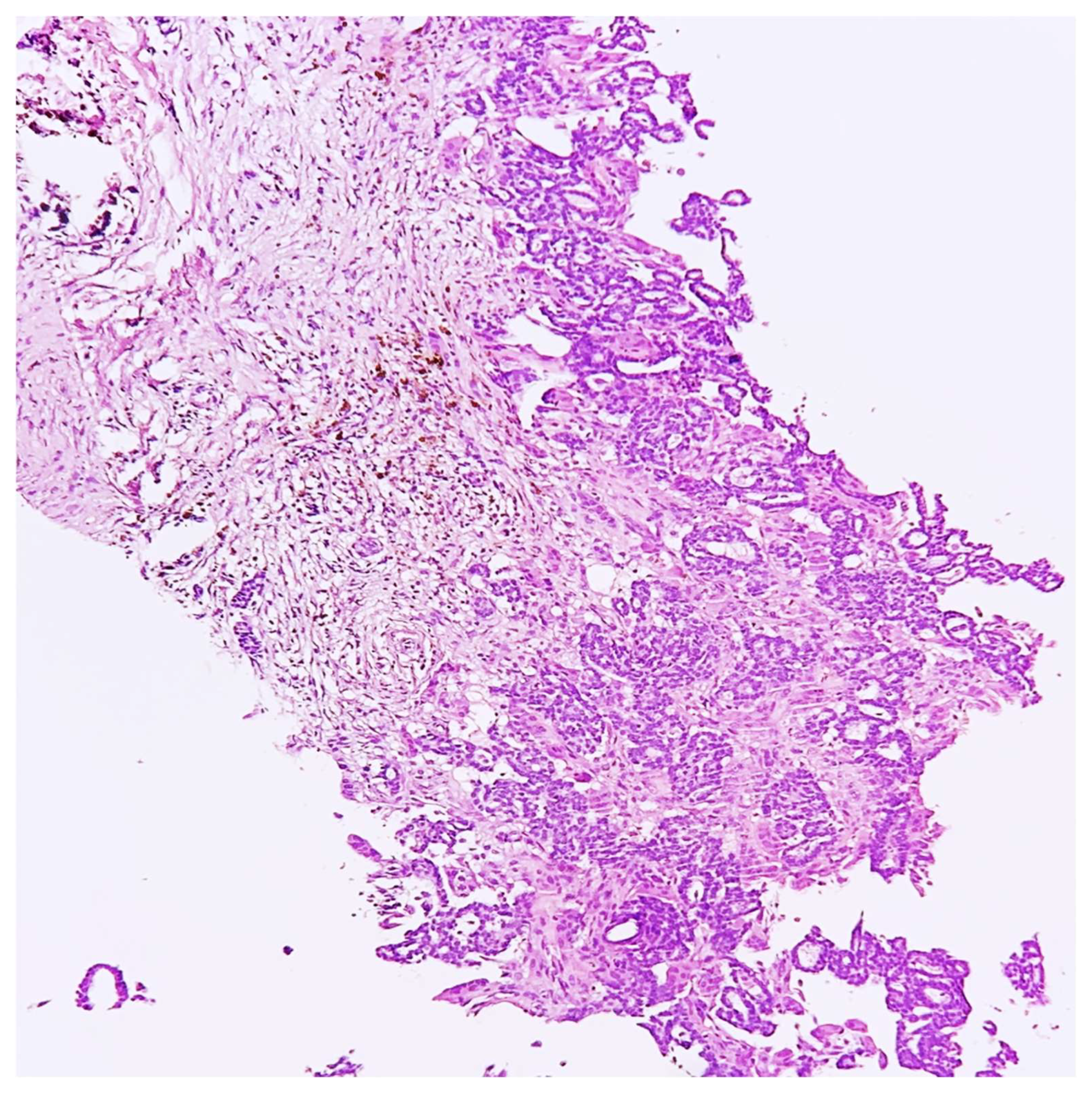 51lpuIARcXL._AC_UF1000,
