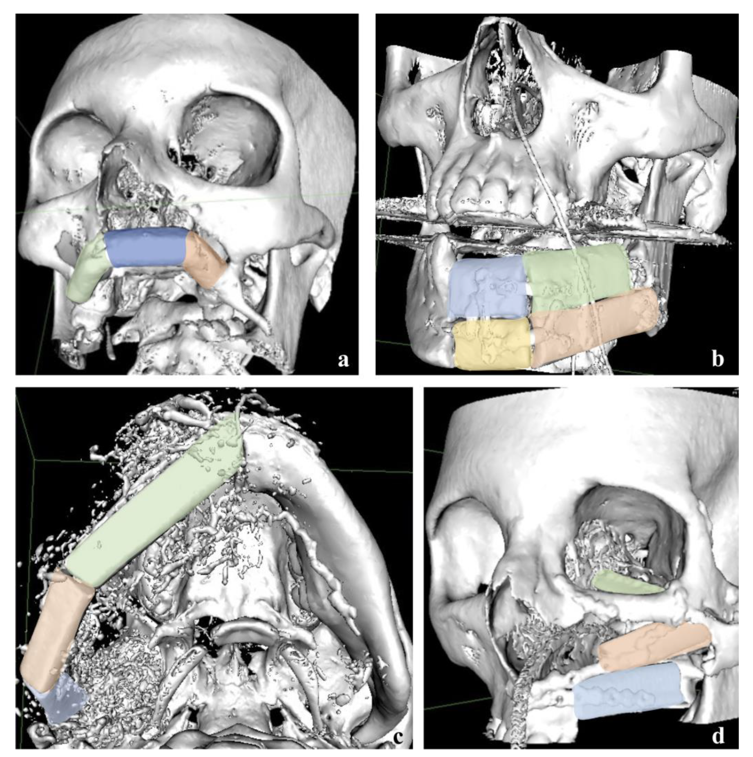 Three consecutive (a) original and reconstructed images using (b)