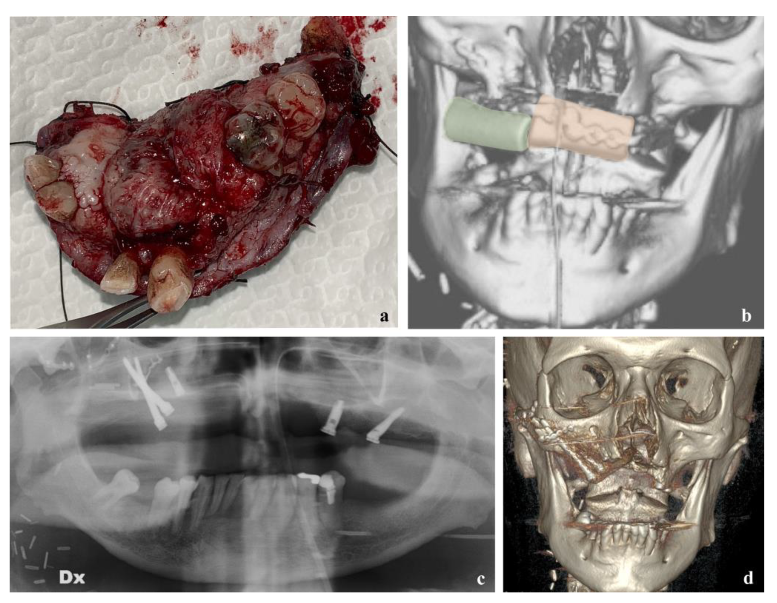 Reports 06 00004 g004 Reports 06 00004 g004