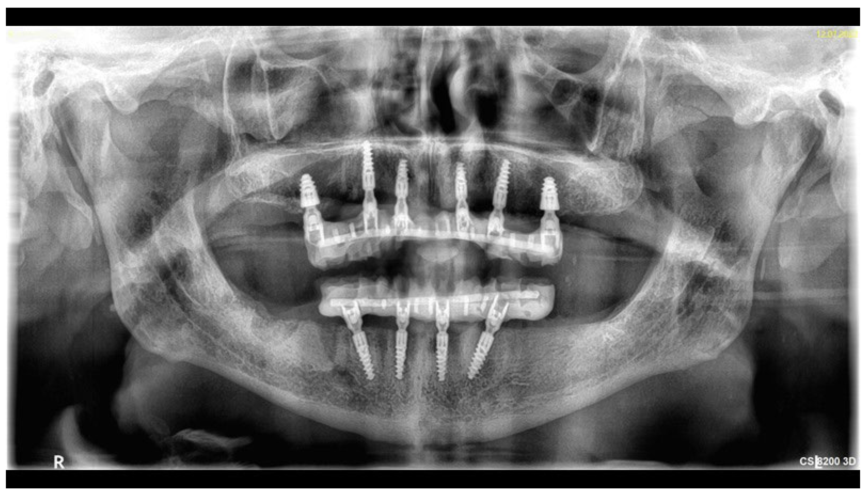 Reports 06 00052 g012