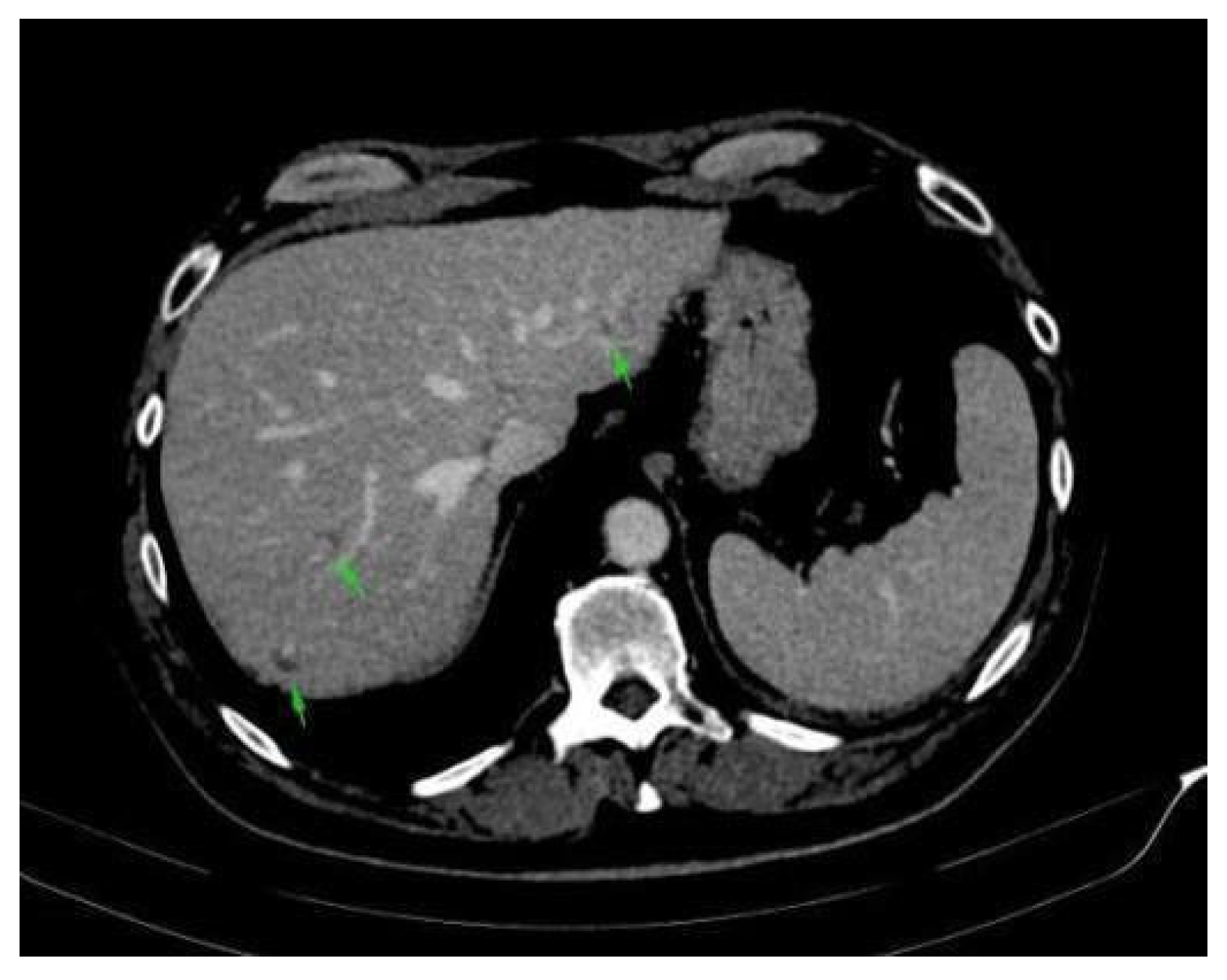 Reports 08 00031 g0a2