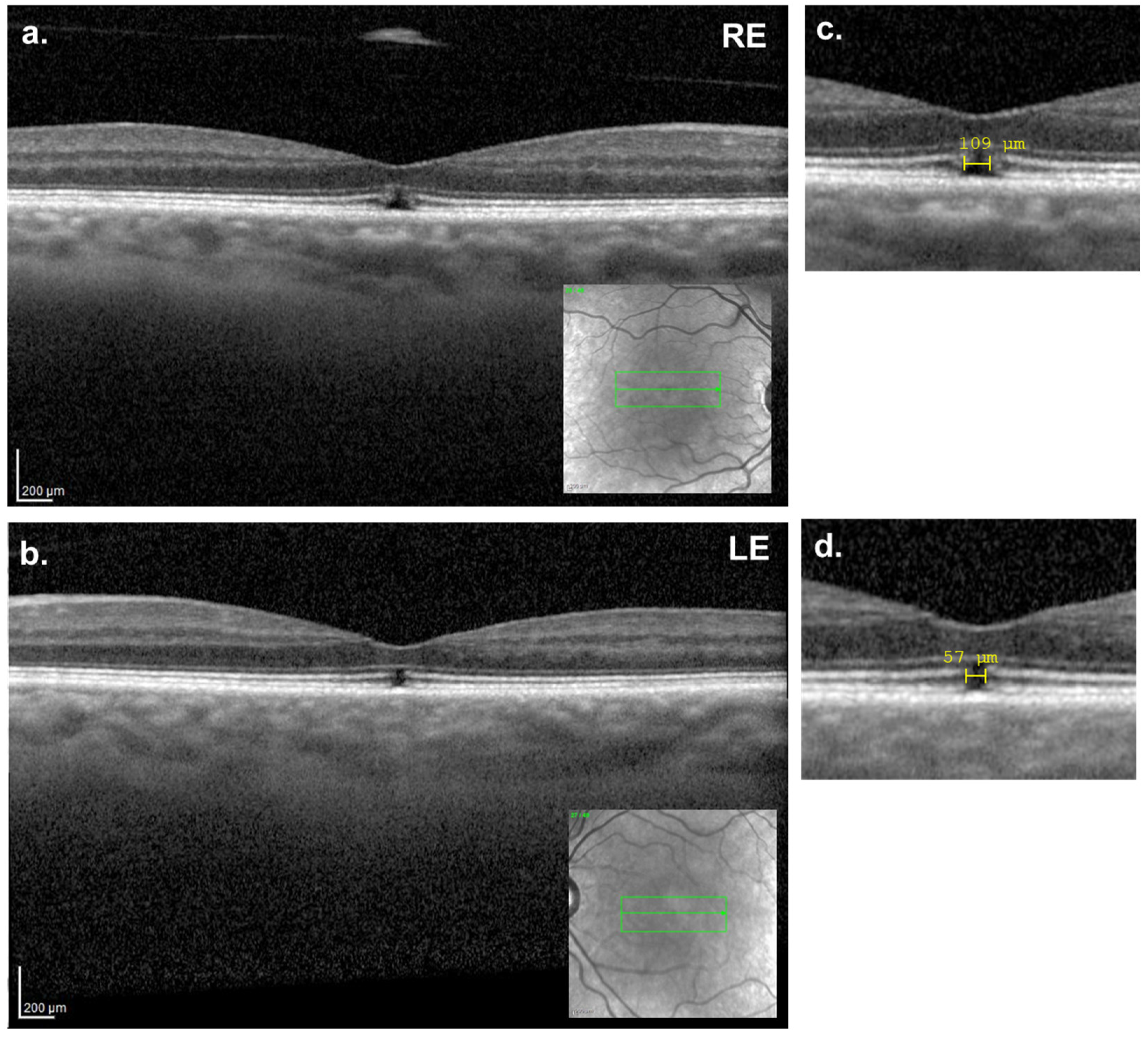Reports 08 00040 g004 Reports 08 00040 g004