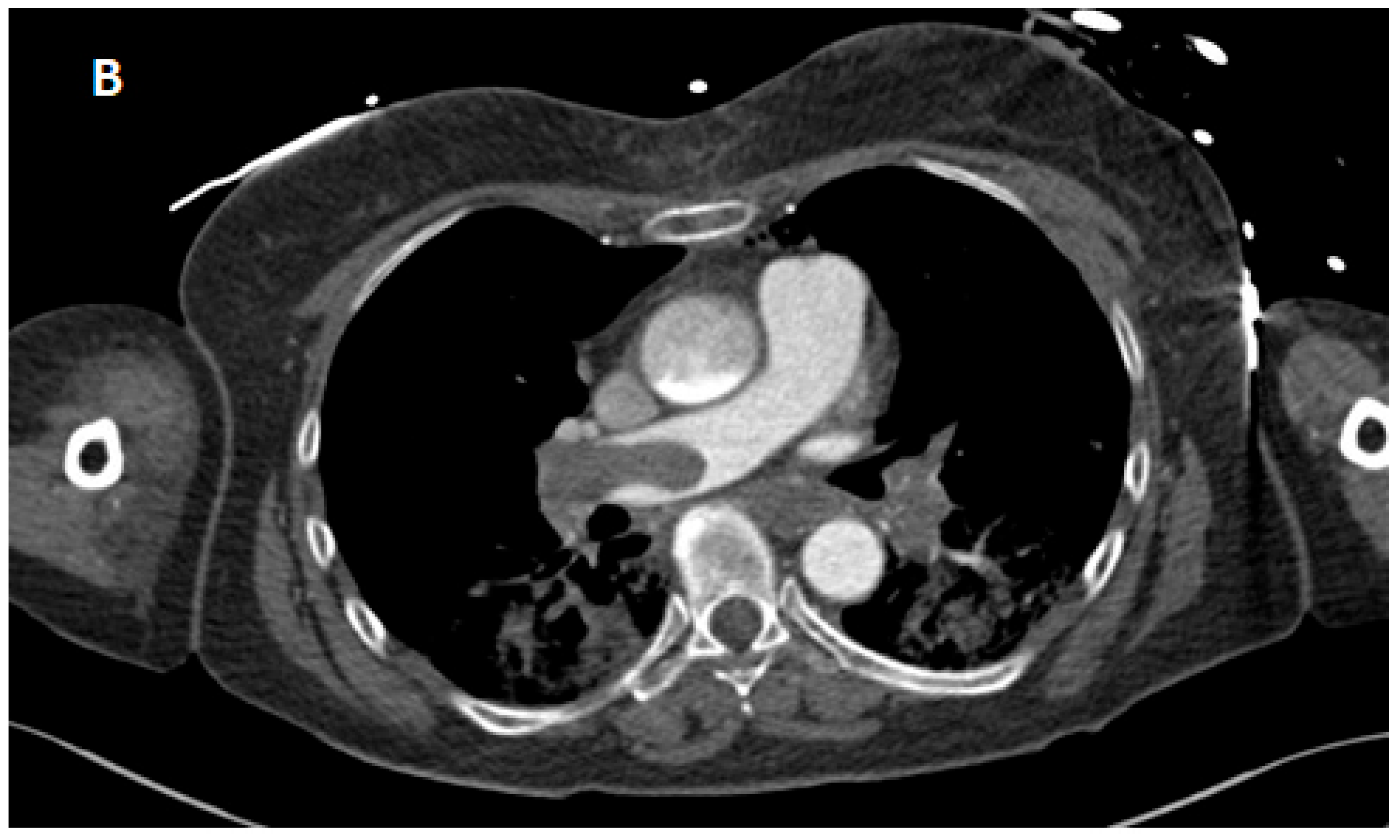 Reports 08 00100 g001b